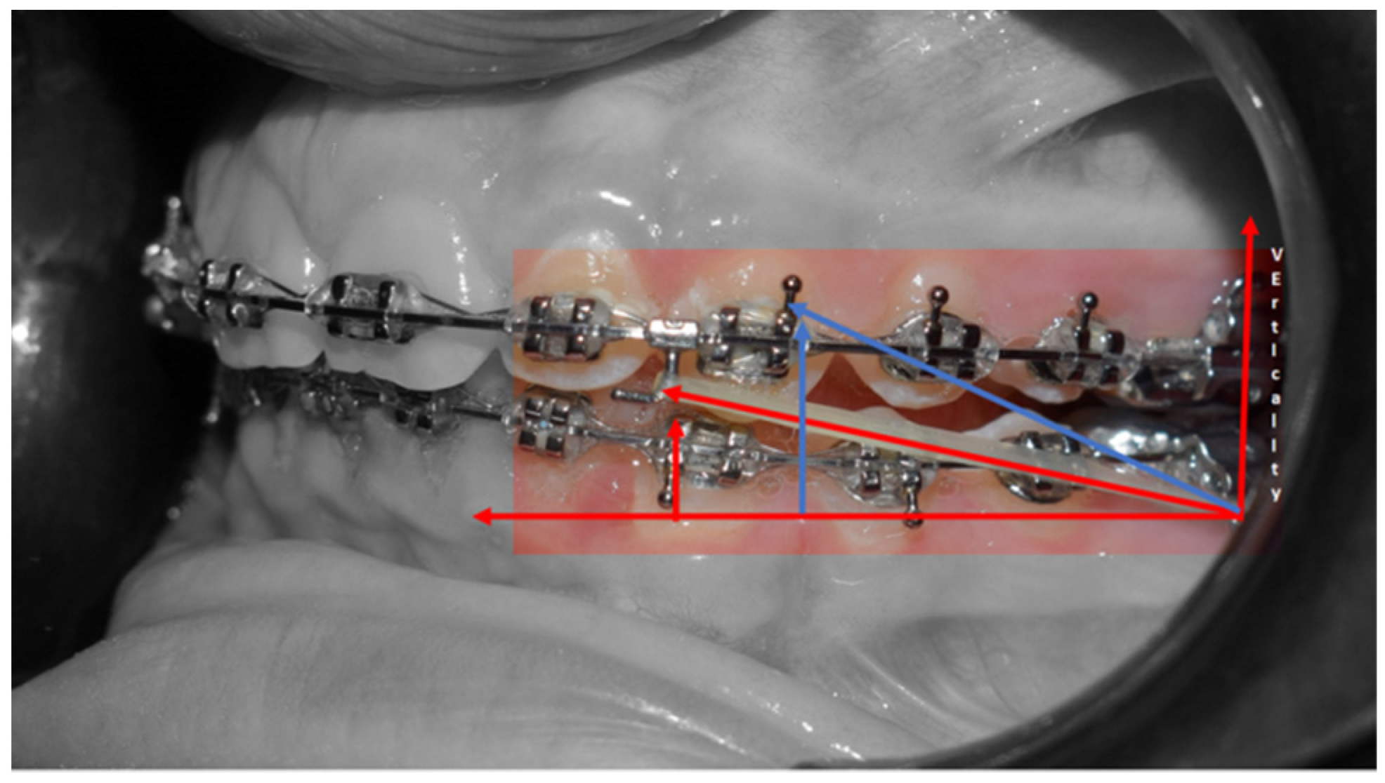 Medicina 59 01774 g007 Medicina 59 01774 g007