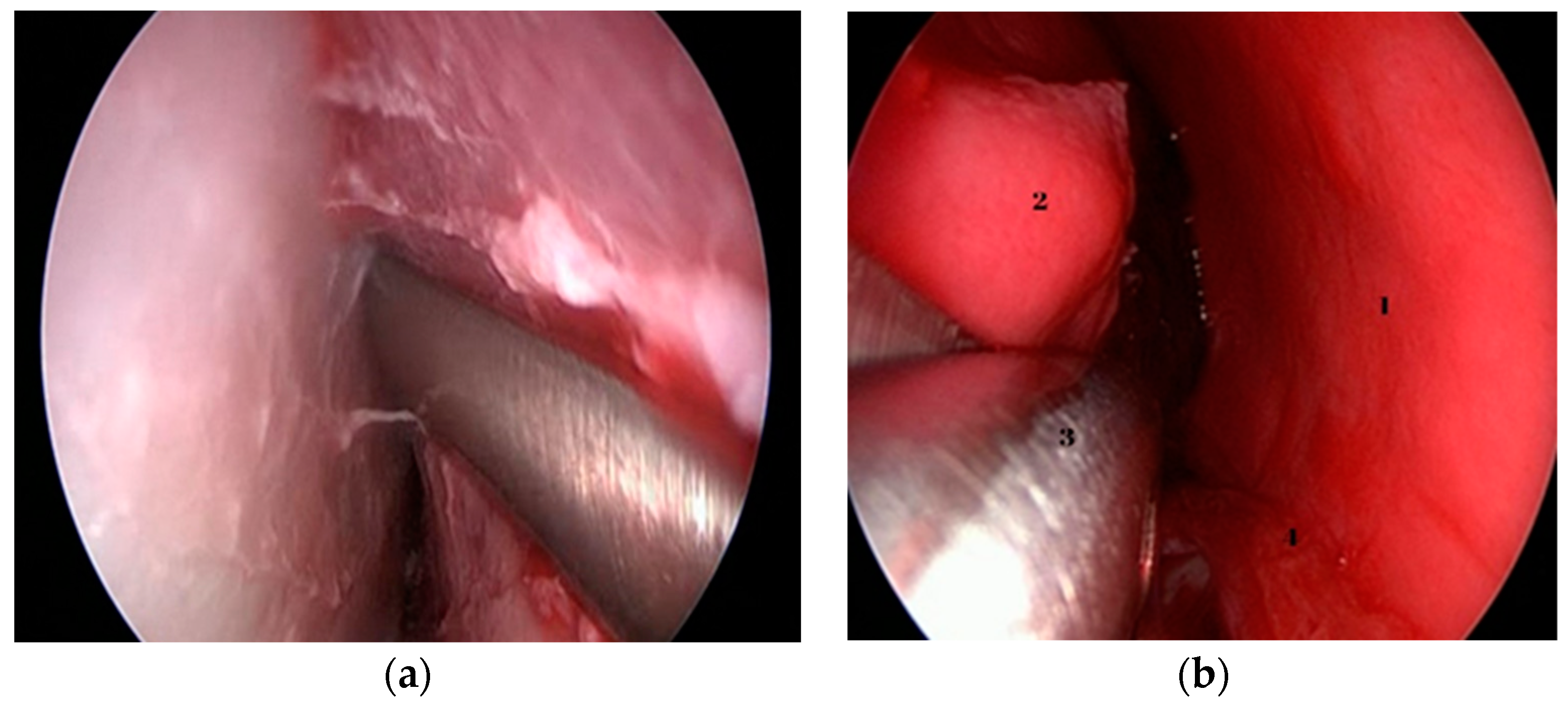 Medicina 59 01792 g004