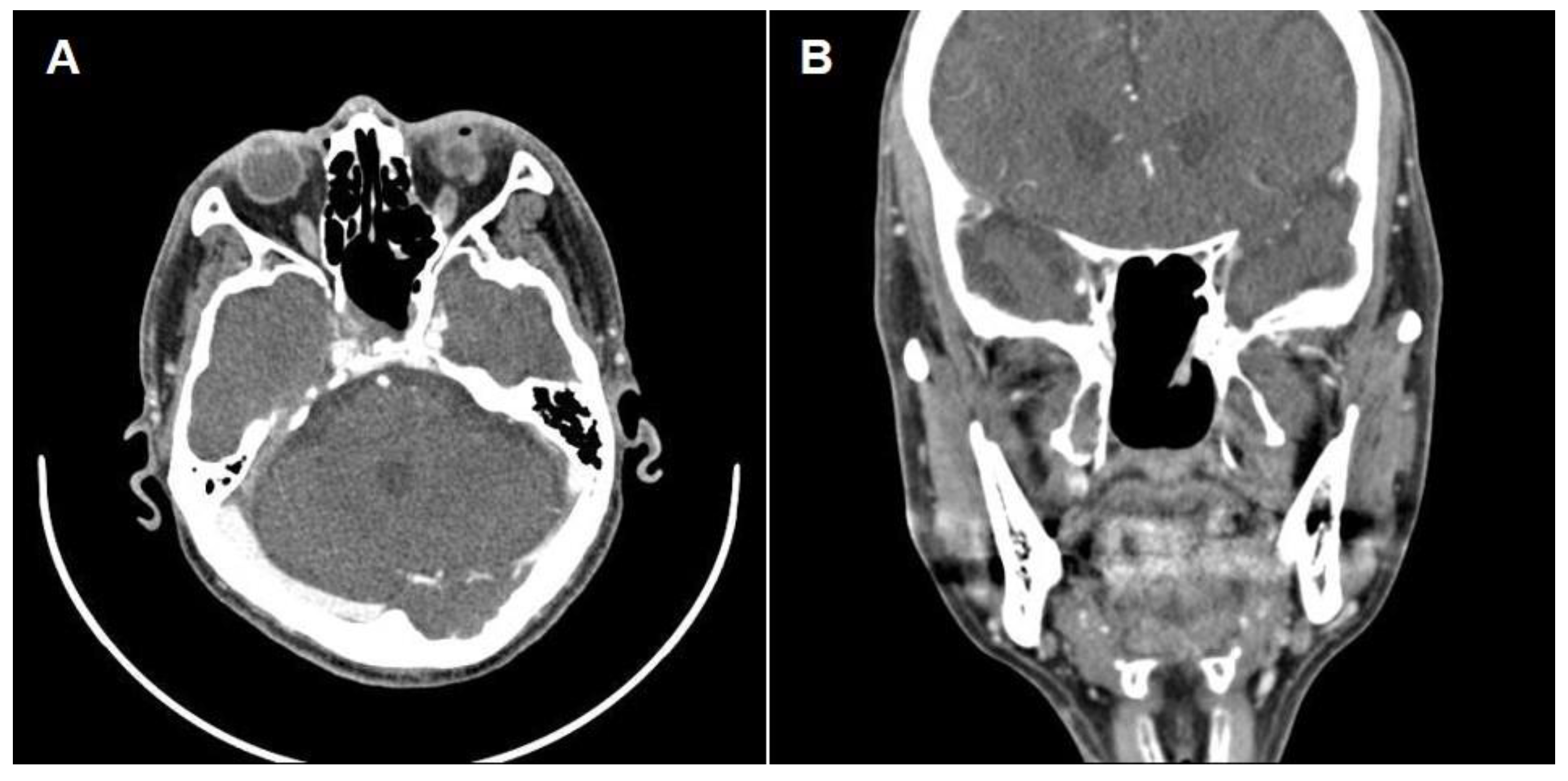 Medicina 59 01802 g005