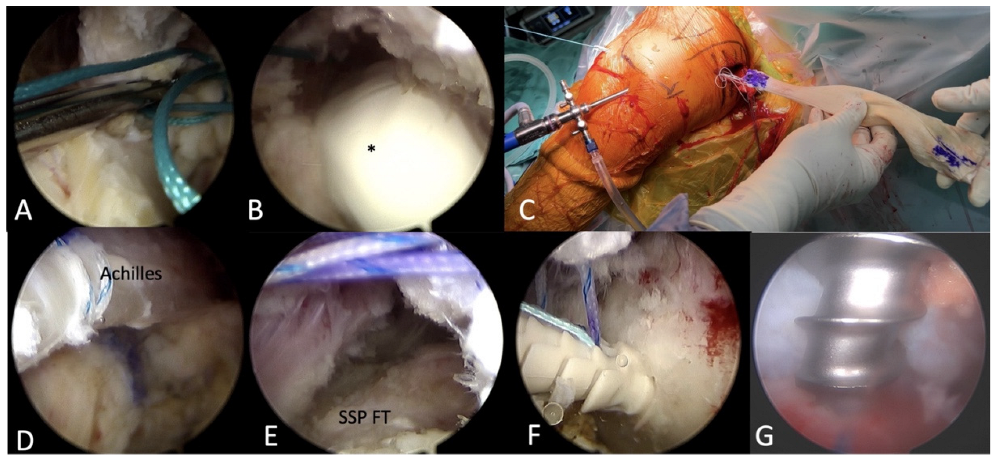 Medicina 59 01817 g005