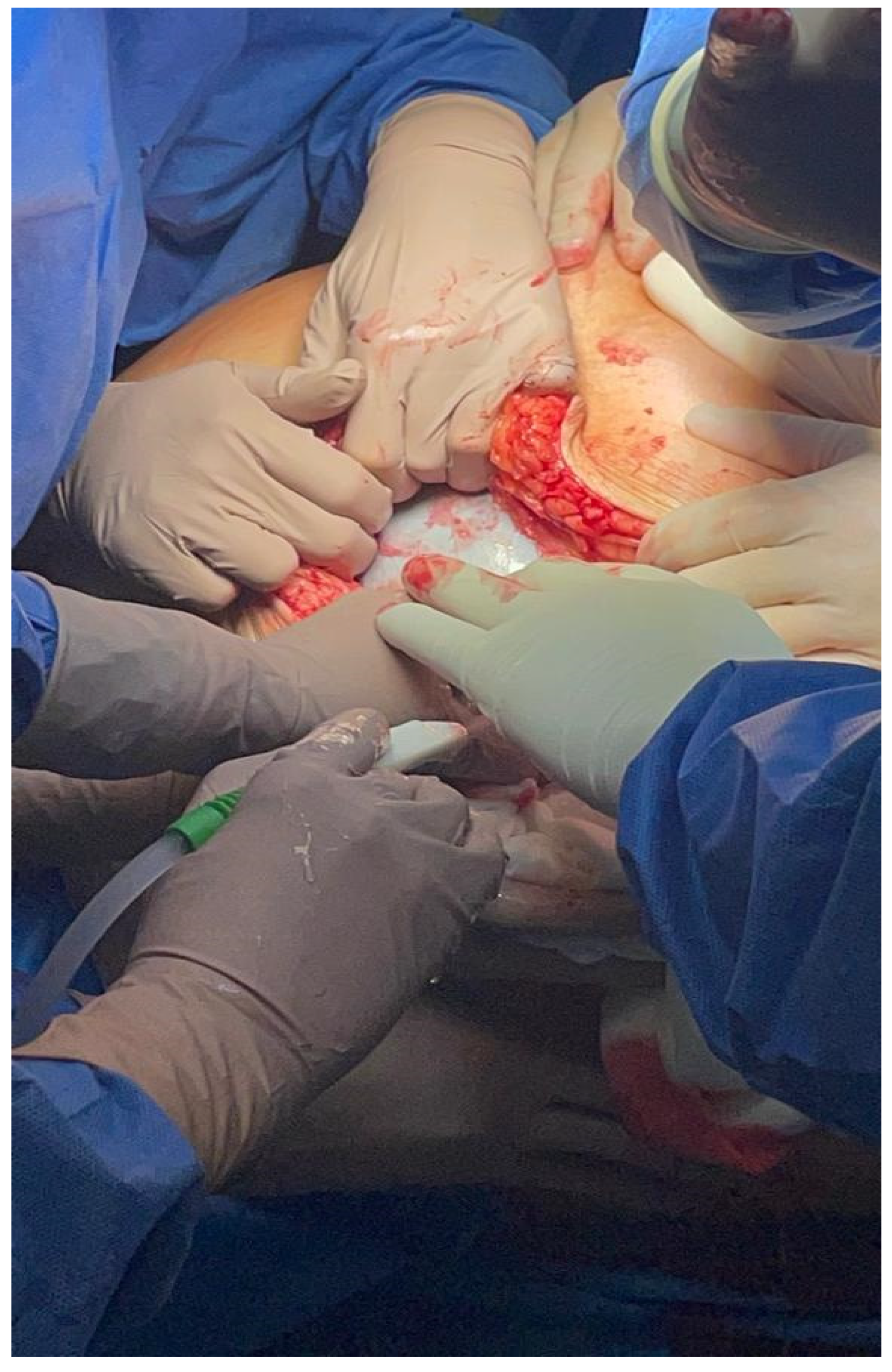 Medicina 59 01833 g004