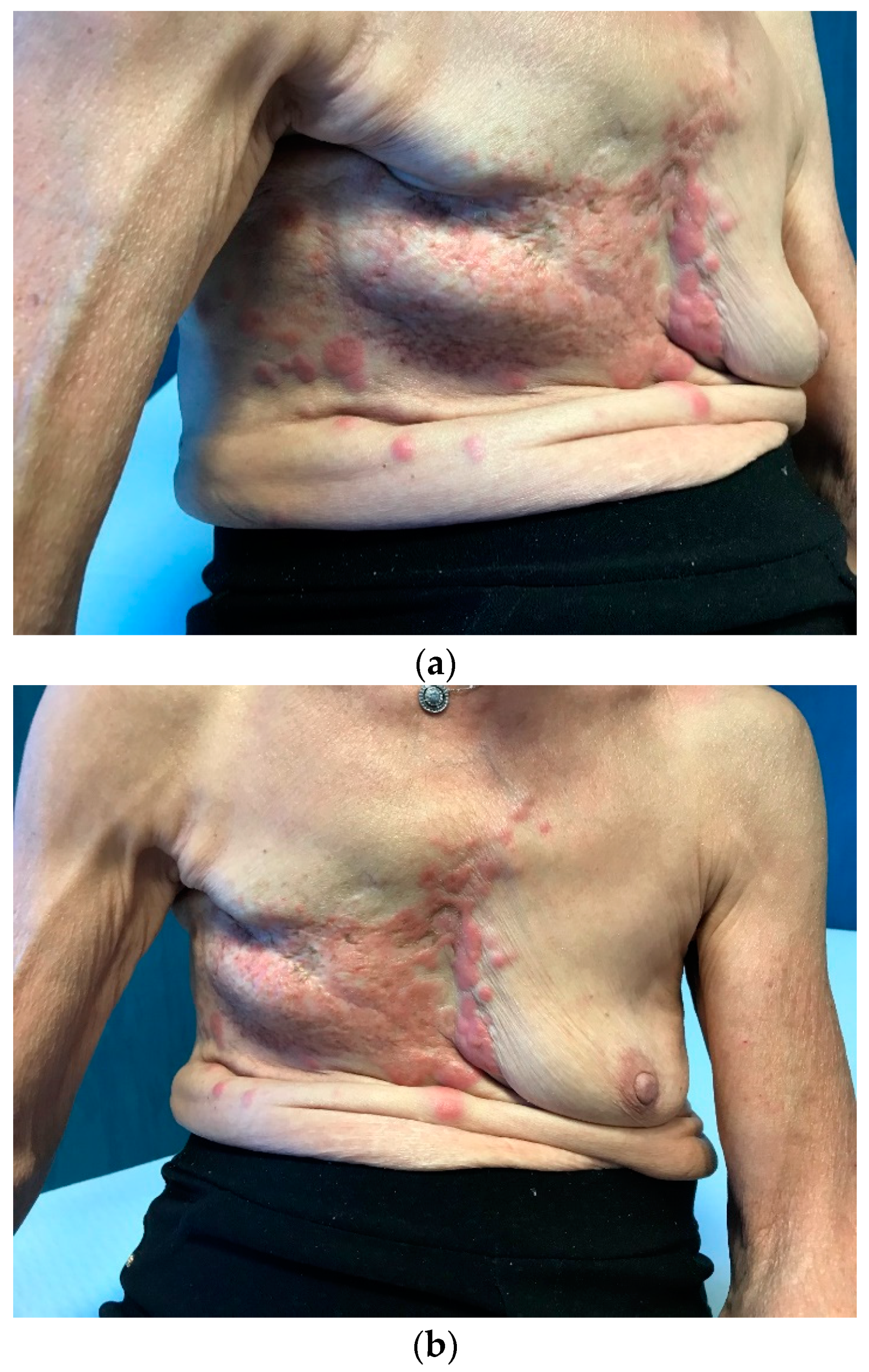 Medicina 59 01875 g003a