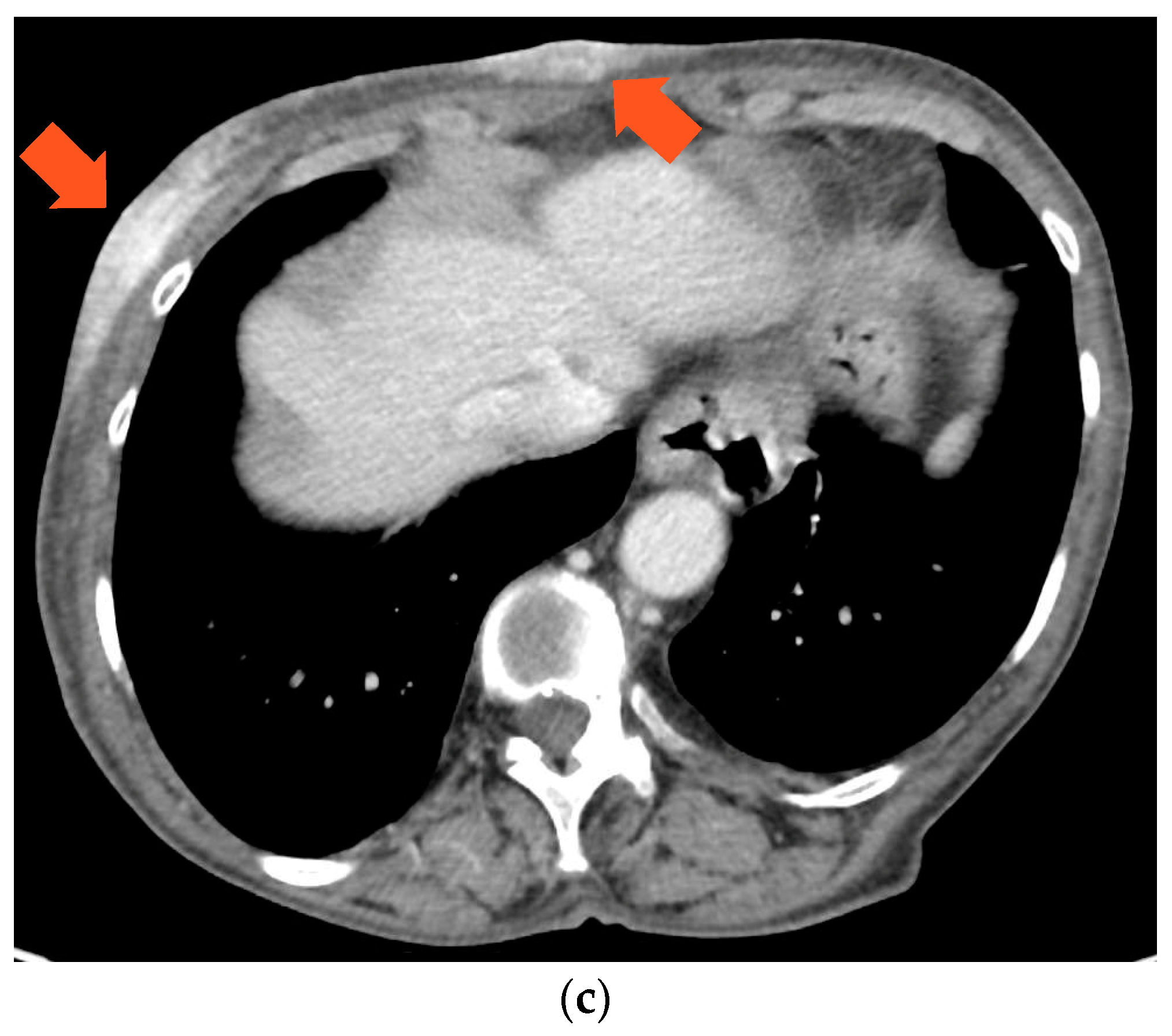 Medicina 59 01875 g003b