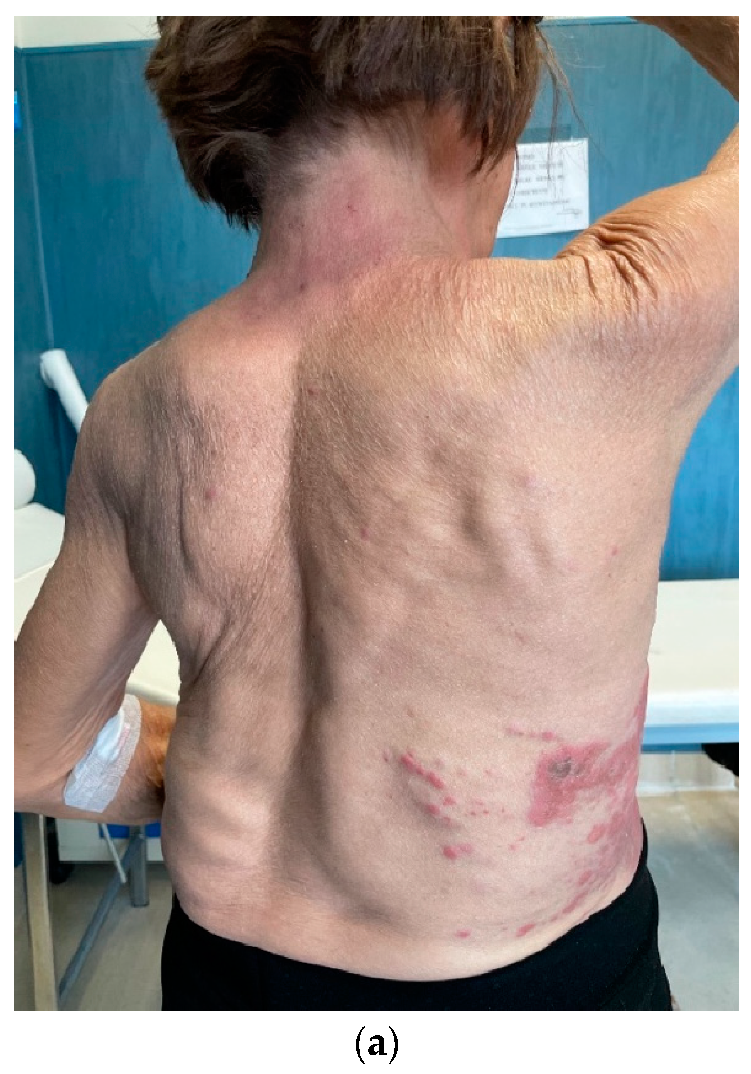 Medicina 59 01875 g004a