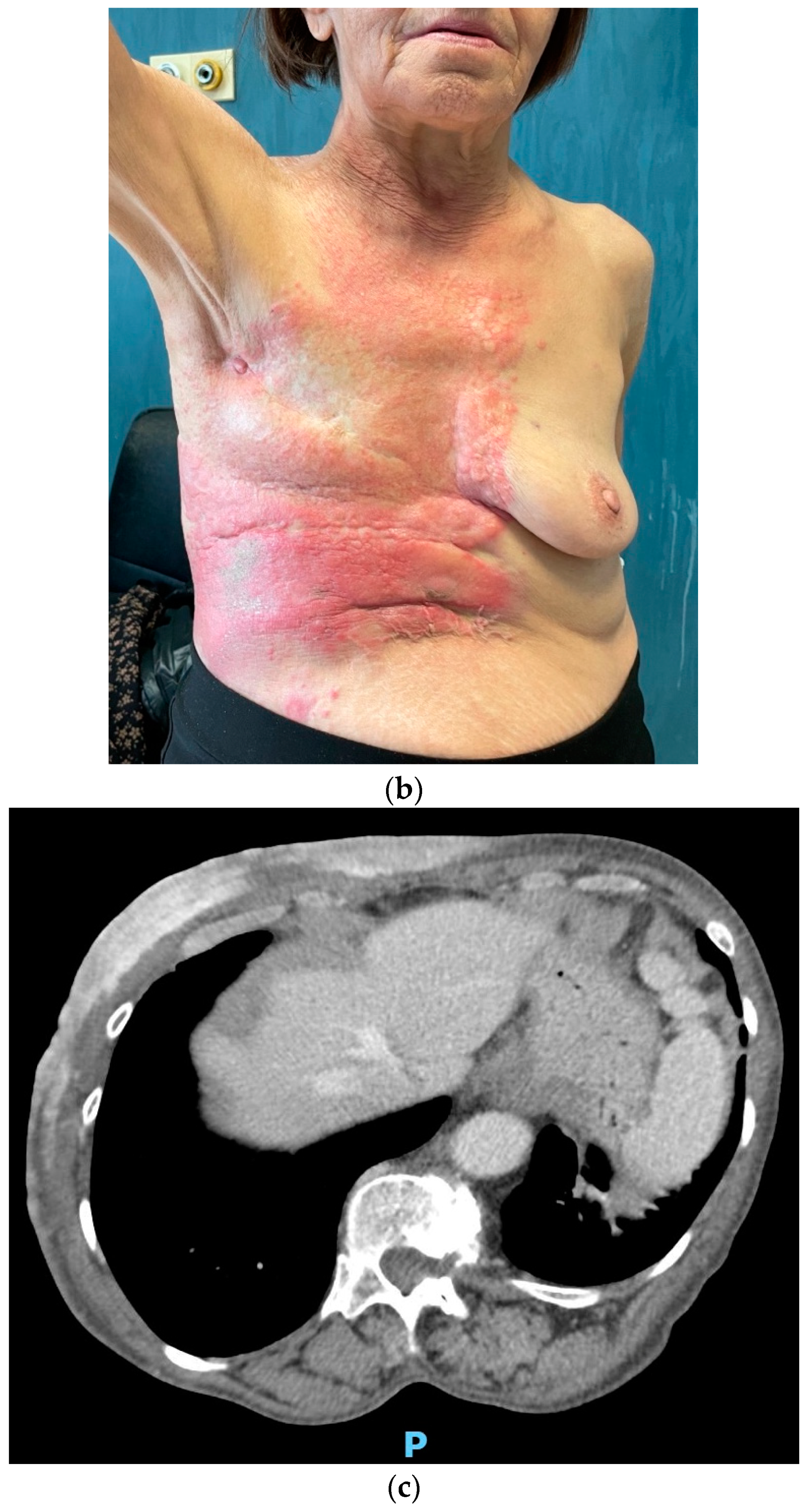 Medicina 59 01875 g004b
