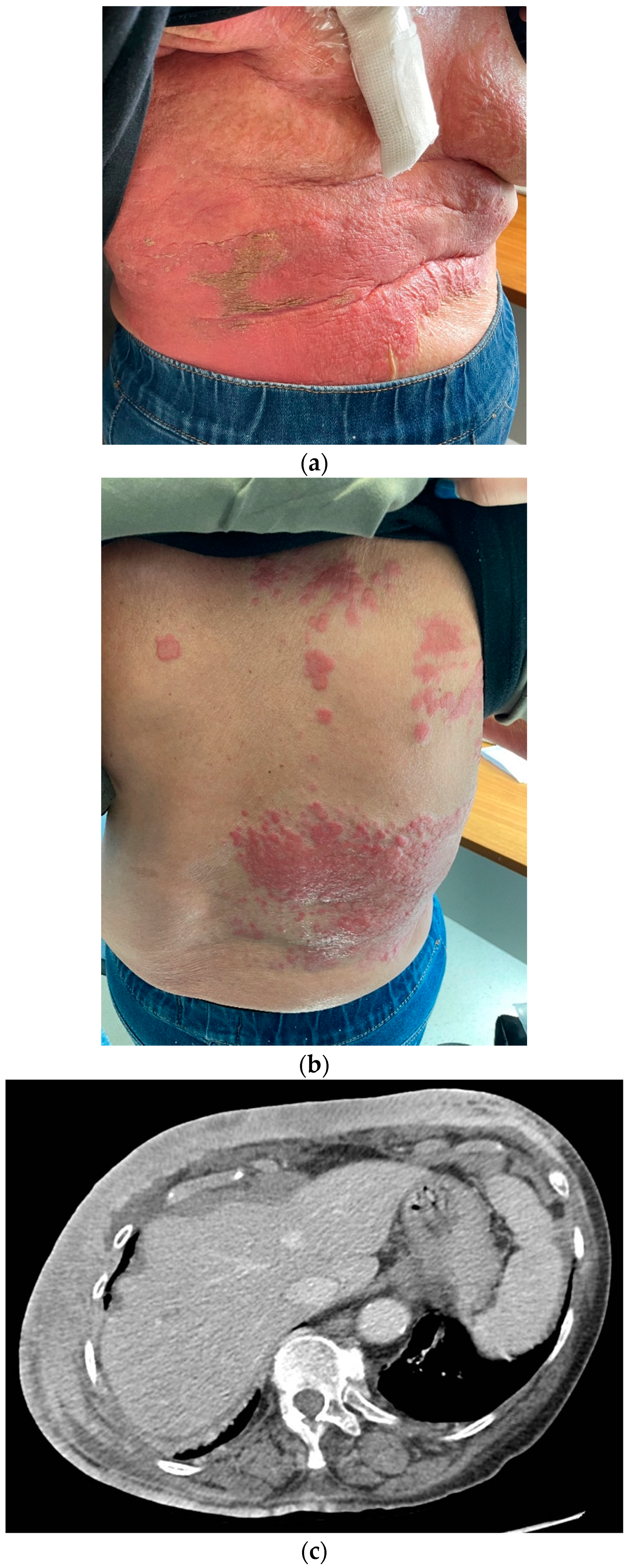 Medicina 59 01875 g005a