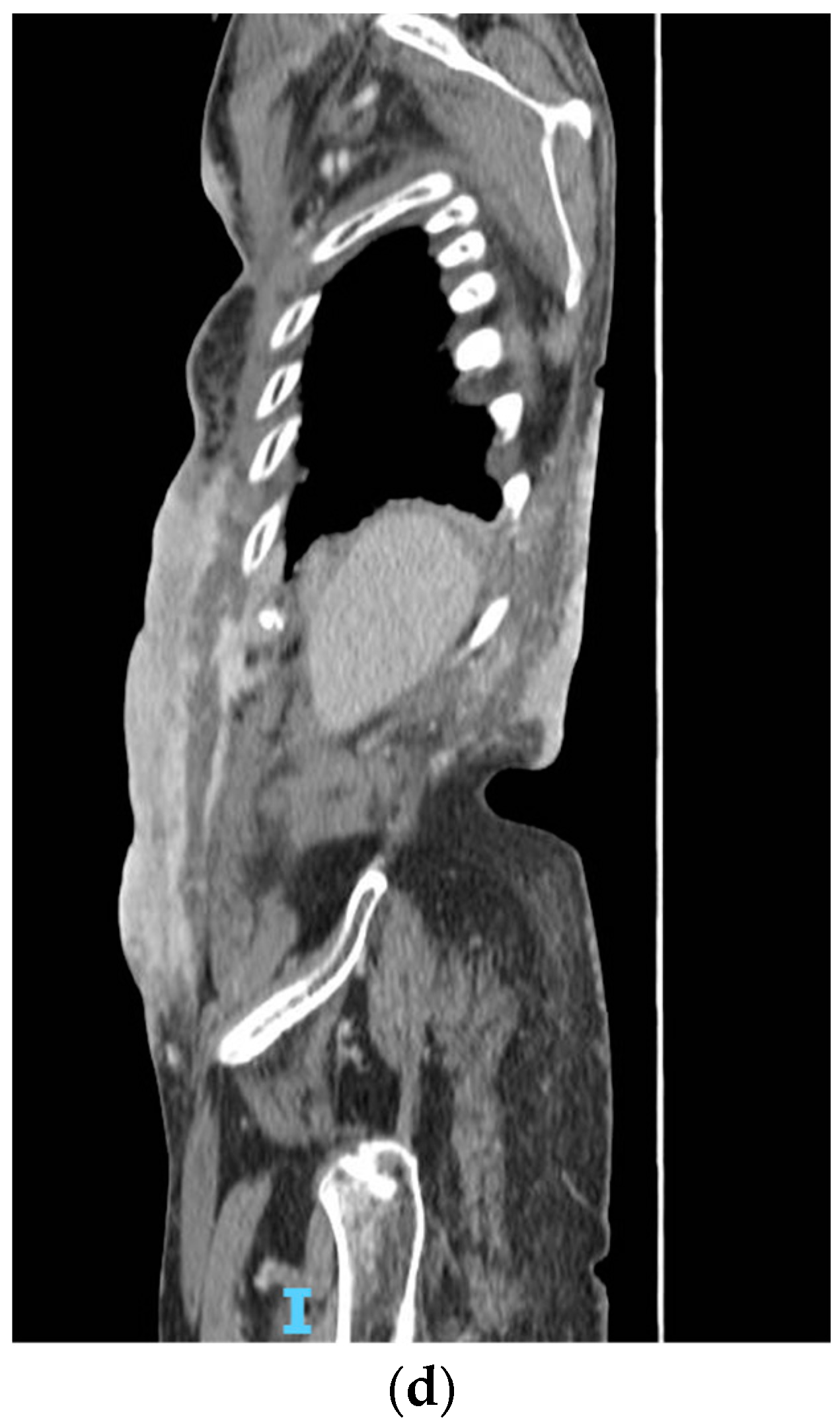 Medicina 59 01875 g005b