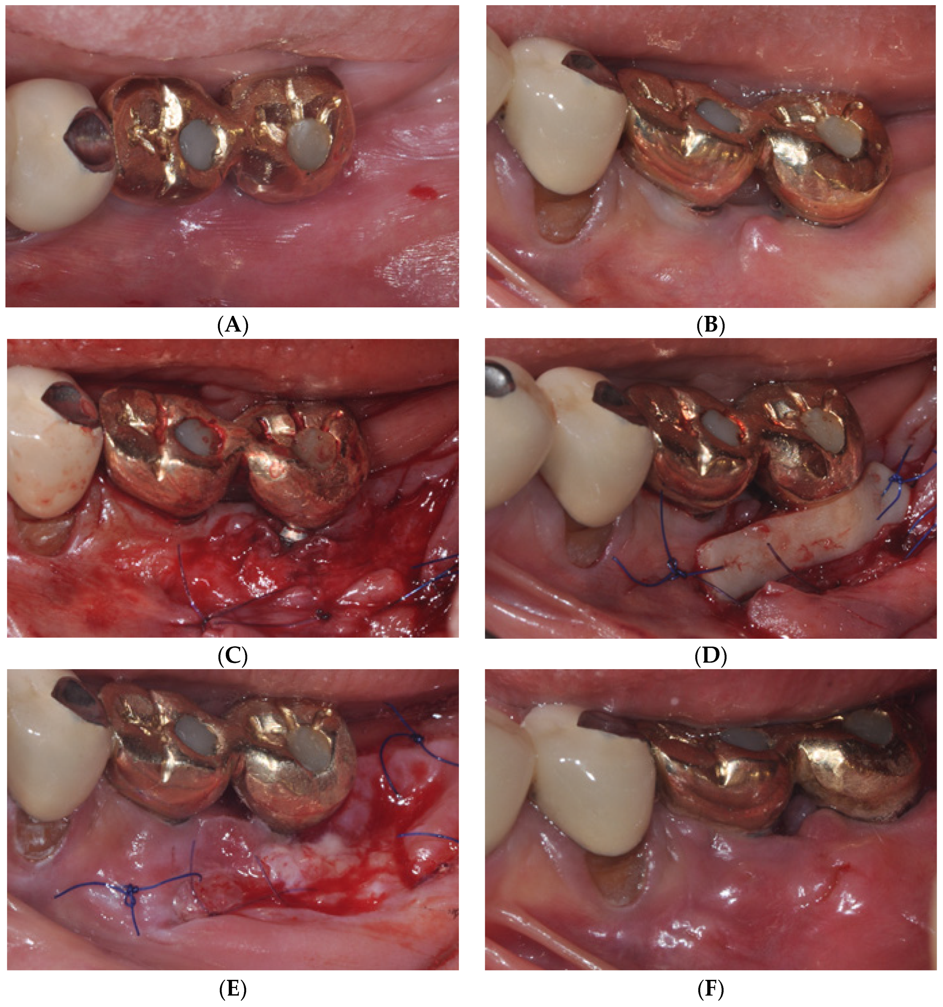 Medicina 59 01884 g003 Medicina 59 01884 g003
