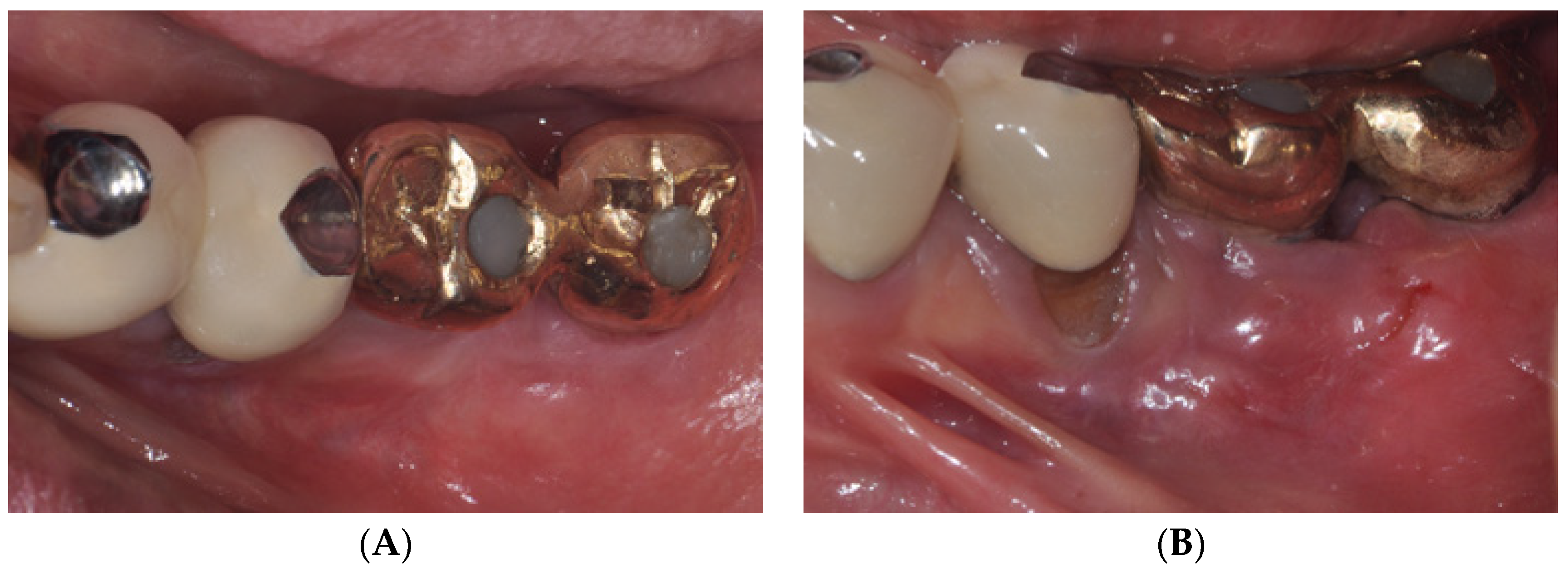 Medicina 59 01884 g004a Medicina 59 01884 g004a