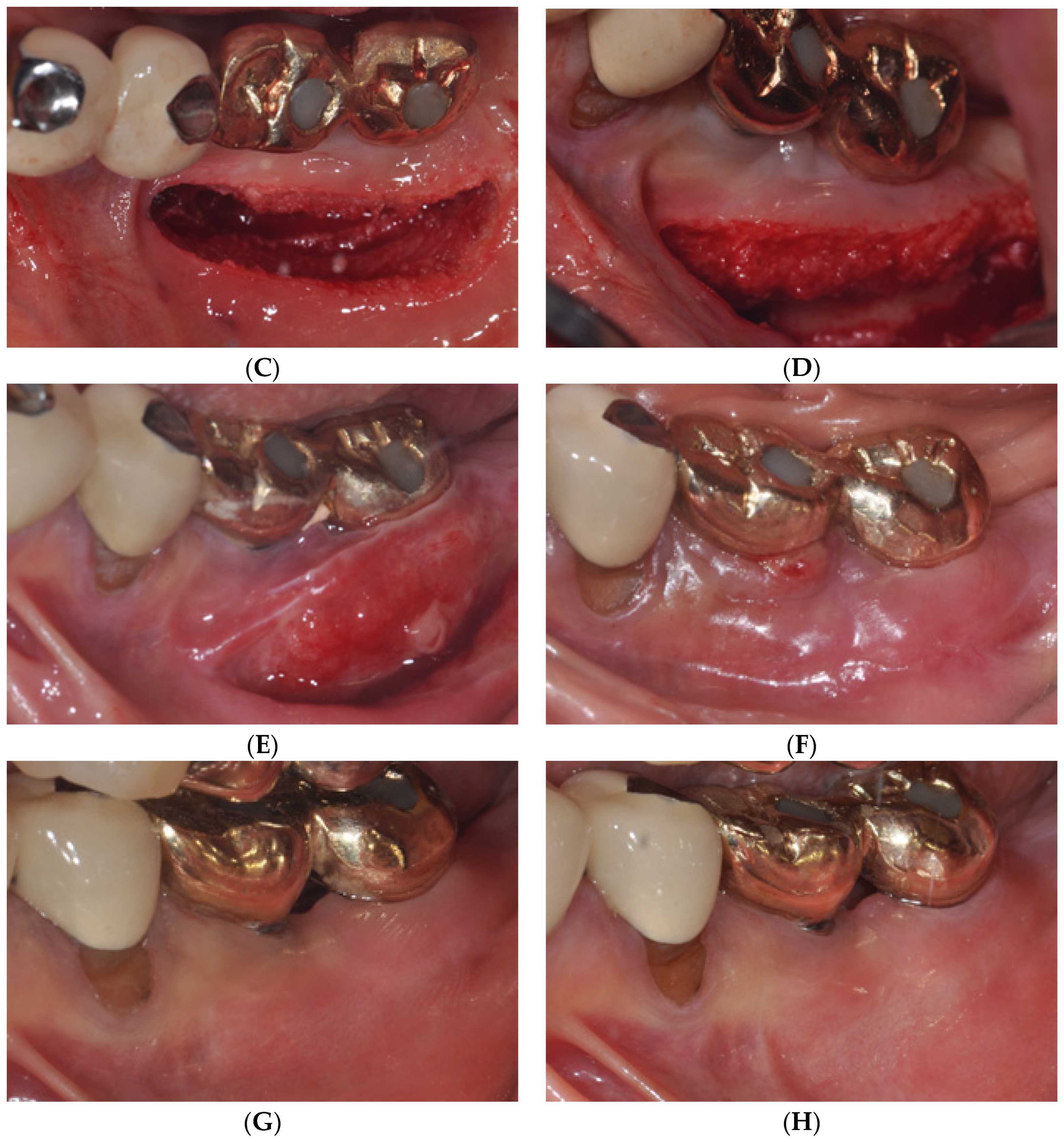 Medicina 59 01884 g004b Medicina 59 01884 g004b