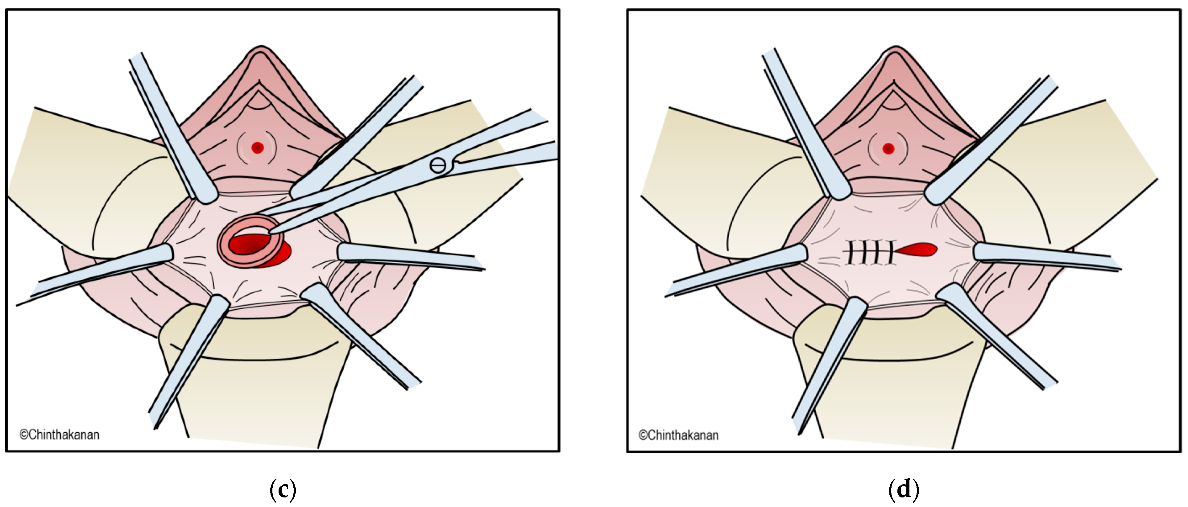 Medicina 59 01947 g003b