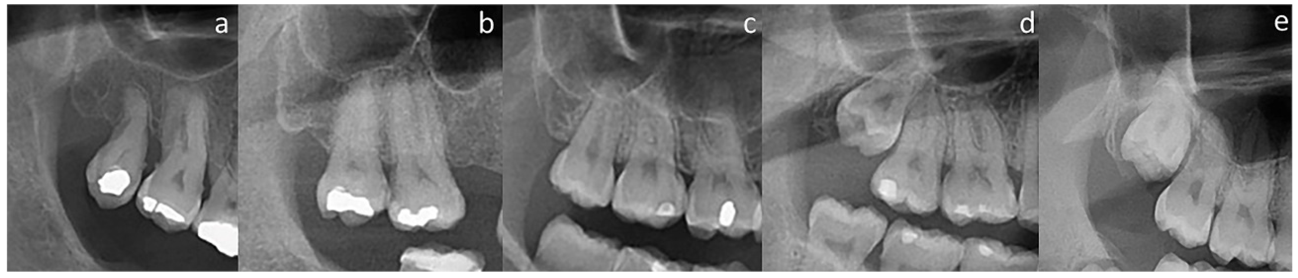 Medicina 59 01975 g002 Medicina 59 01975 g002