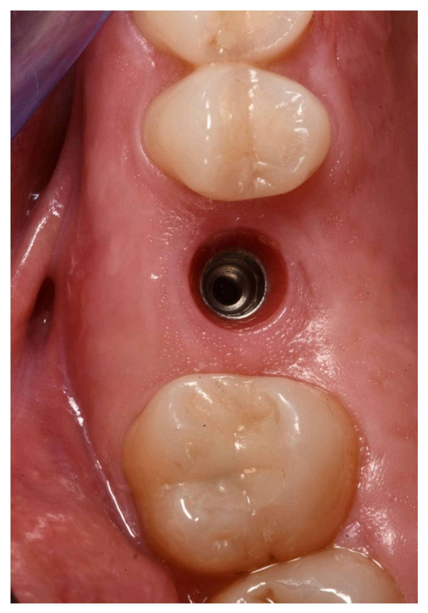 Medicina 59 01978 g014