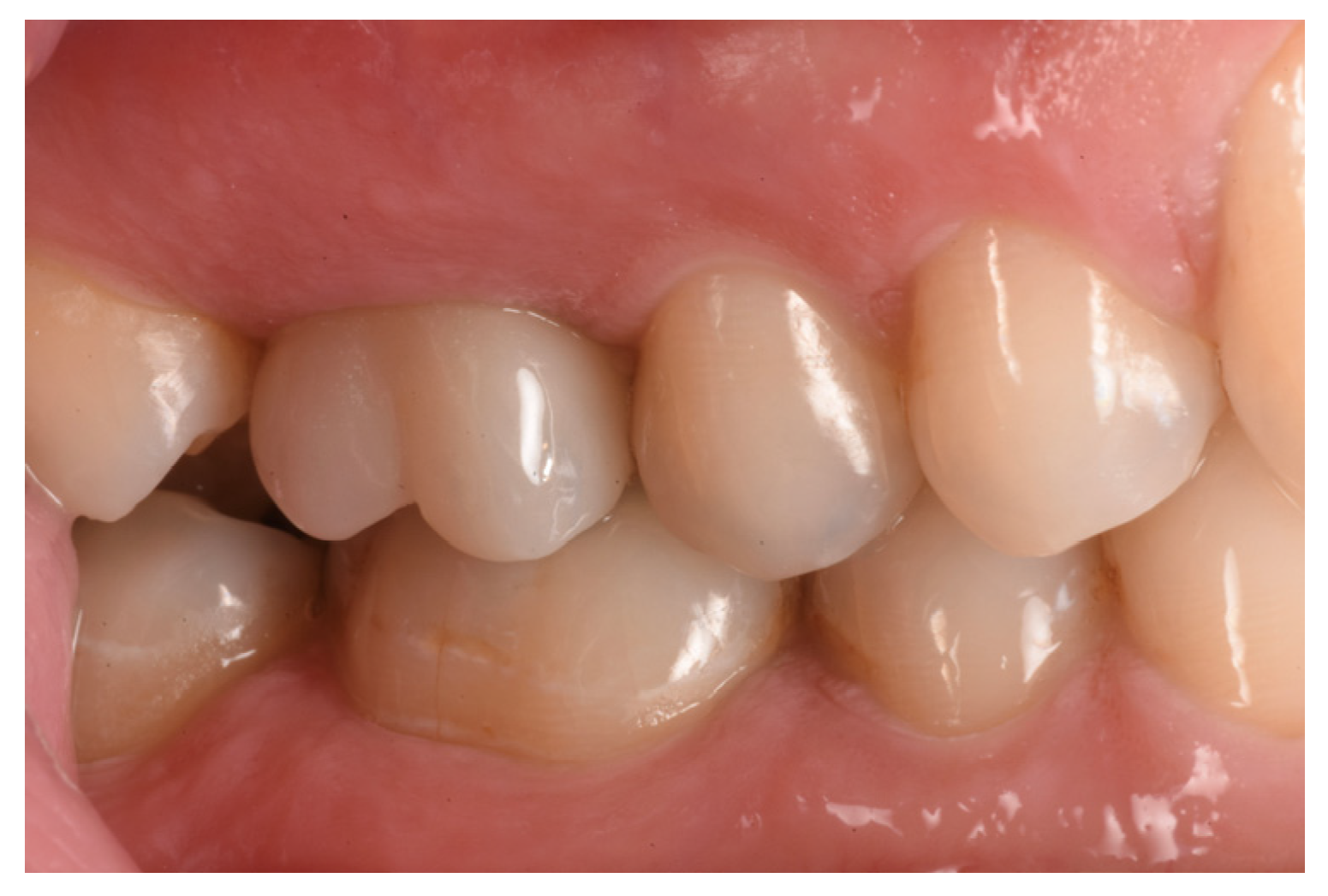 Medicina 59 01978 g015