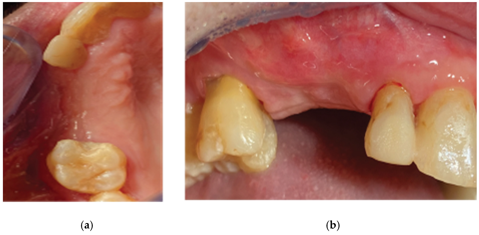 Medicina 59 01994 g011