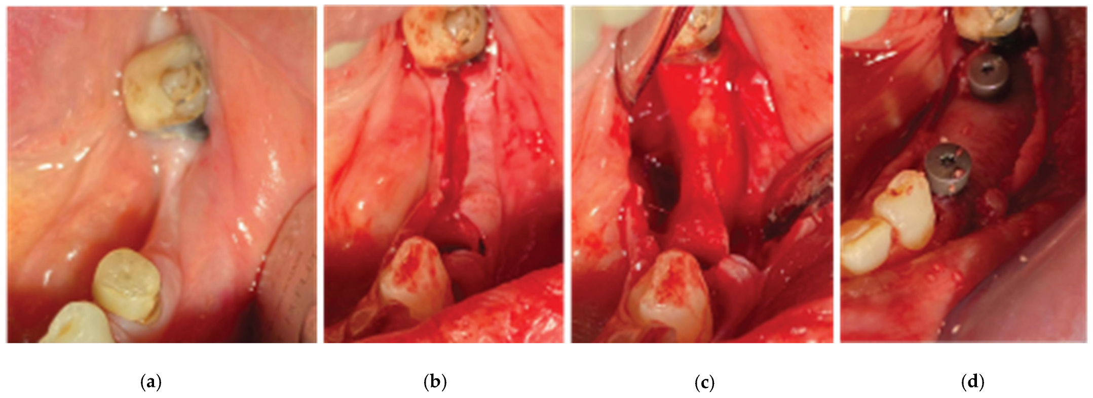 Medicina 59 01994 g017
