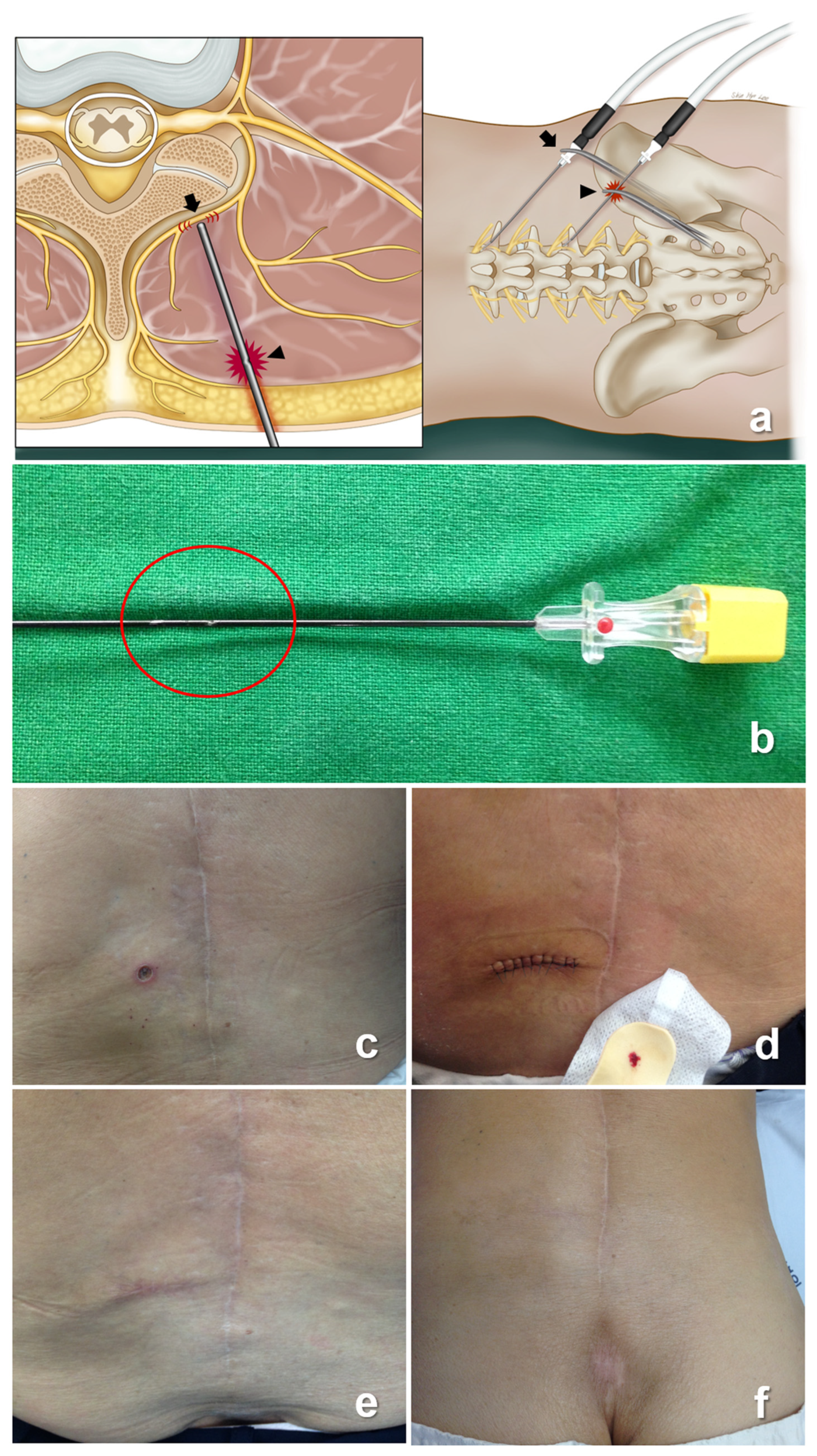 Medicina 59 01996 g002