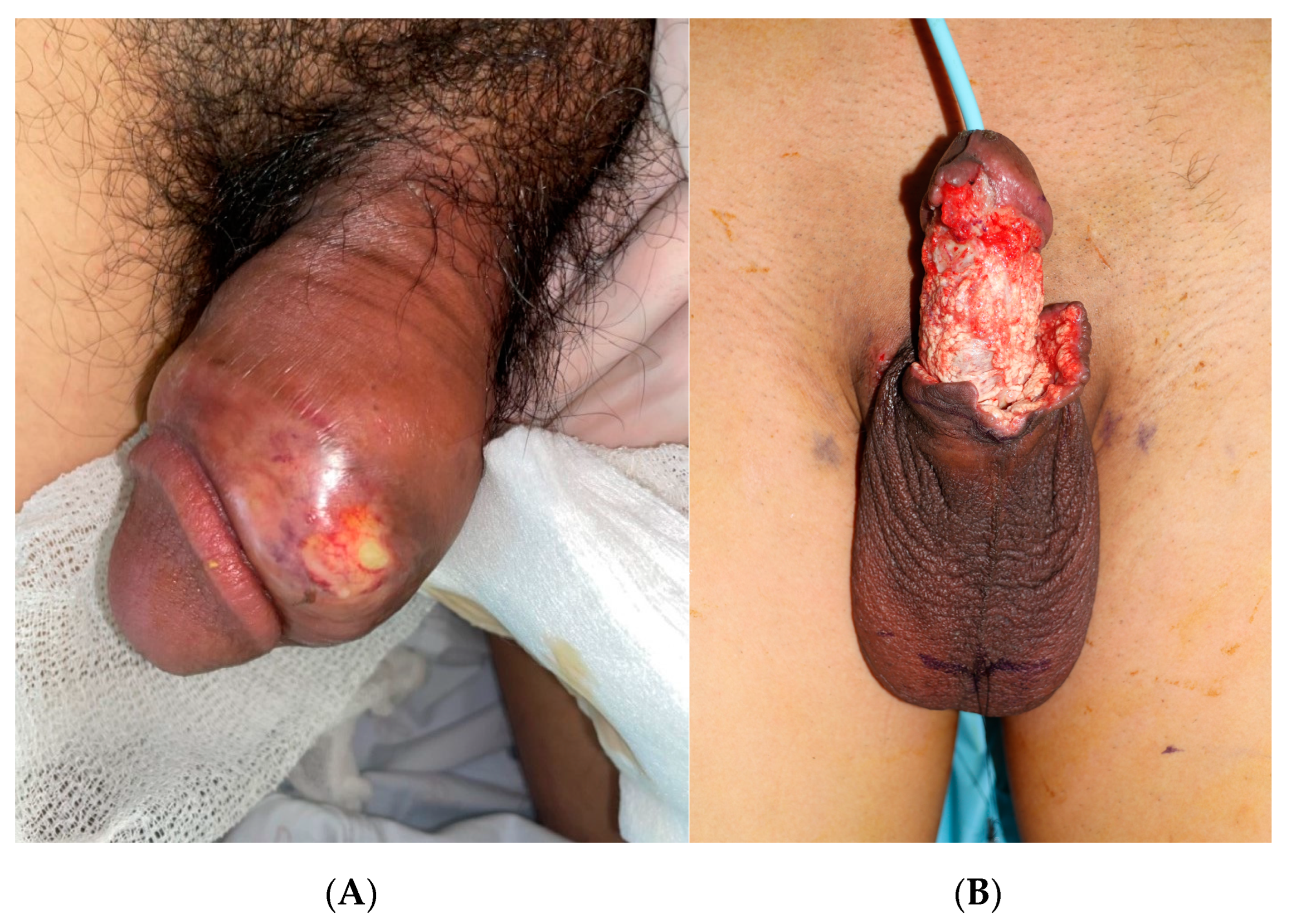 Medicina 59 01998 g001