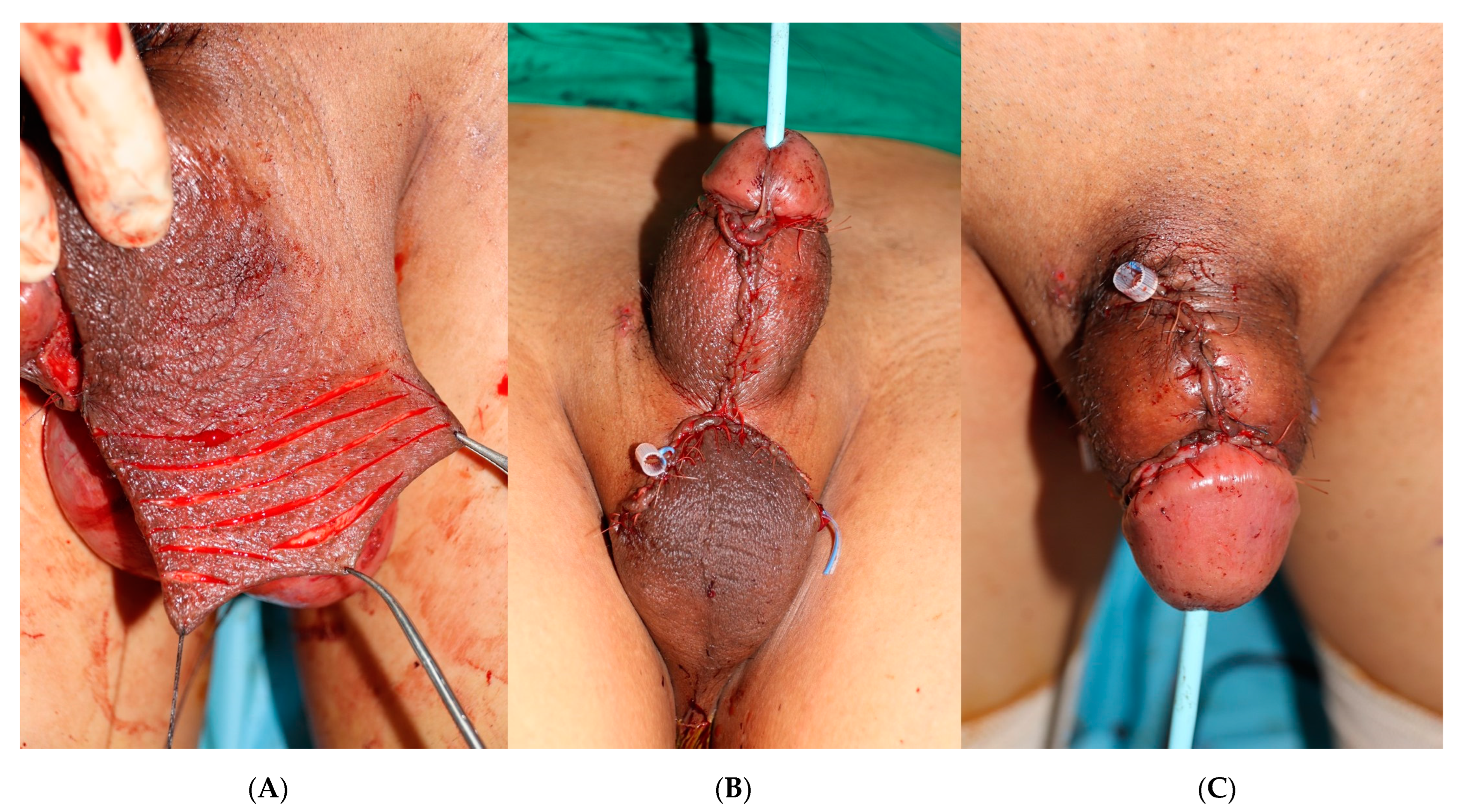 Medicina 59 01998 g003