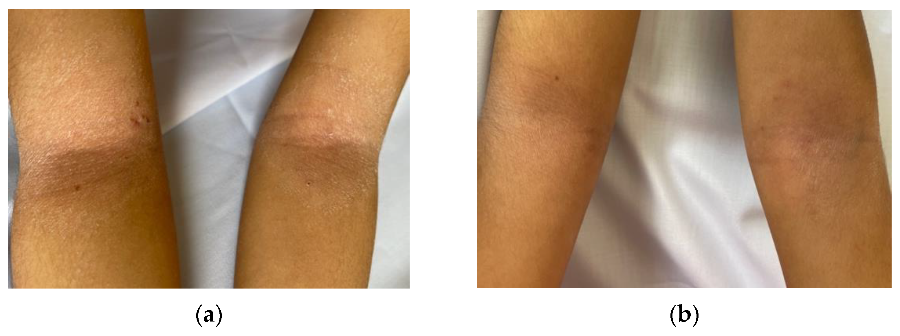 Medicina 59 02007 g001 Medicina 59 02007 g001