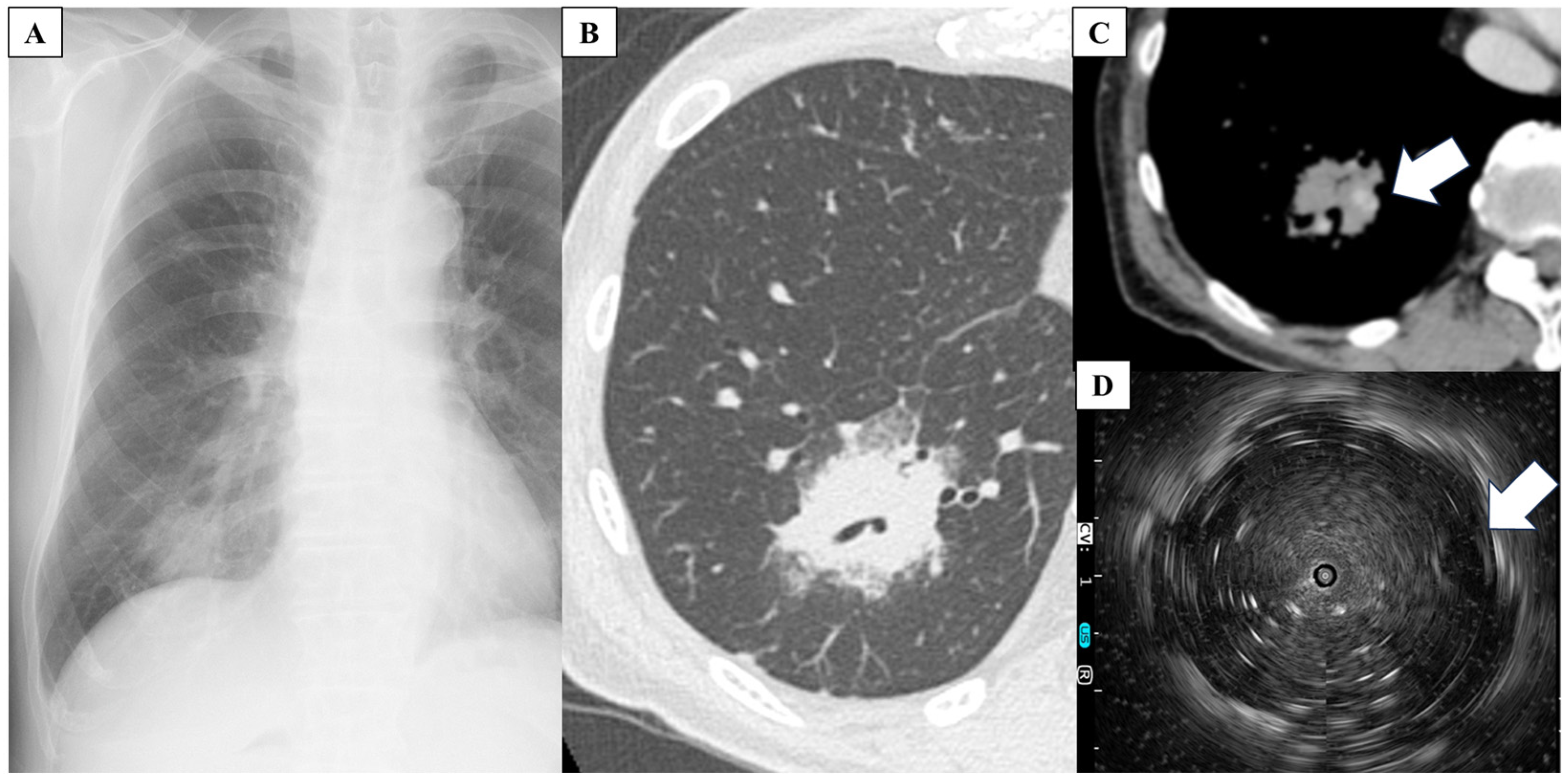 Medicina 59 02015 g001 Medicina 59 02015 g001