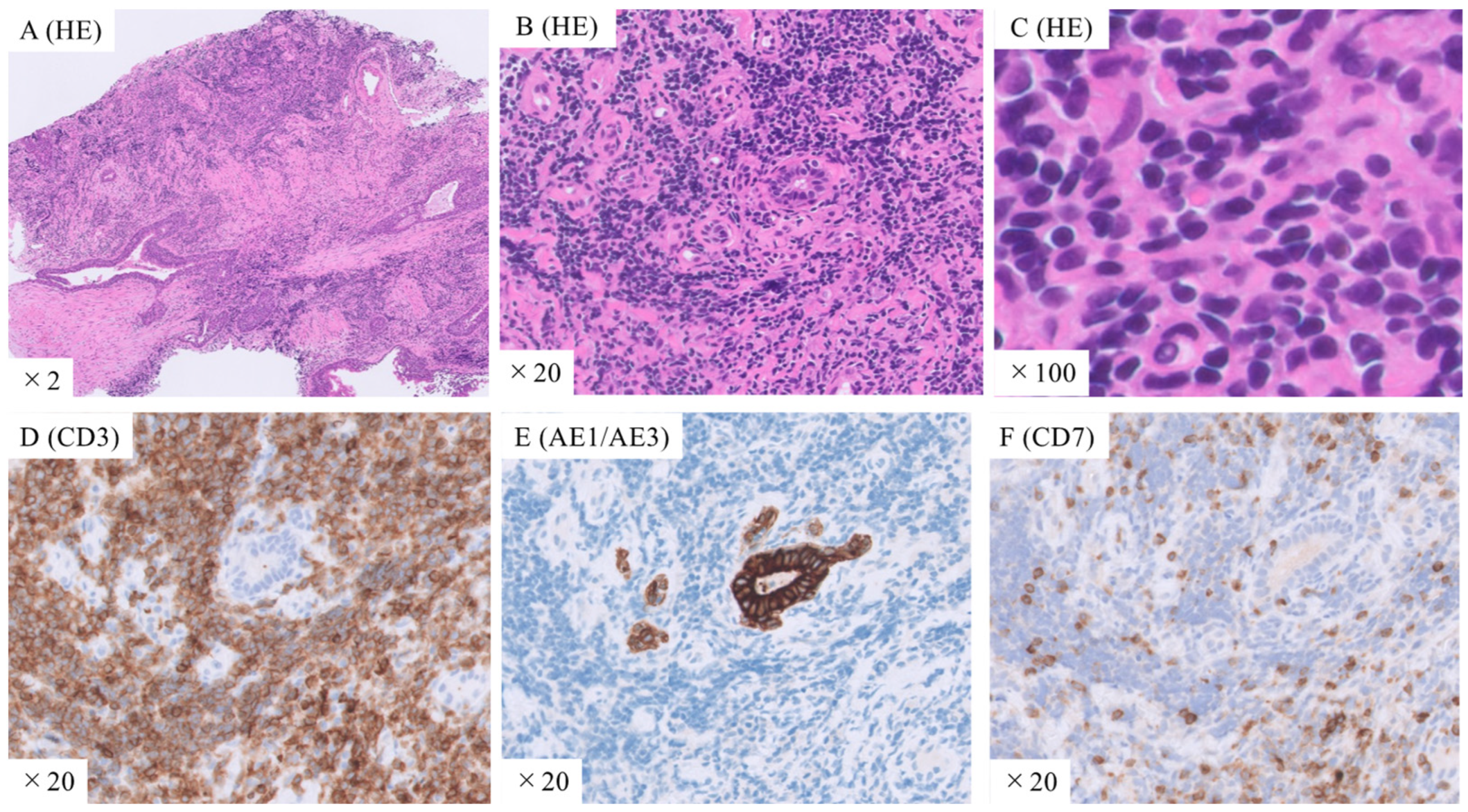 Medicina 59 02015 g002 Medicina 59 02015 g002