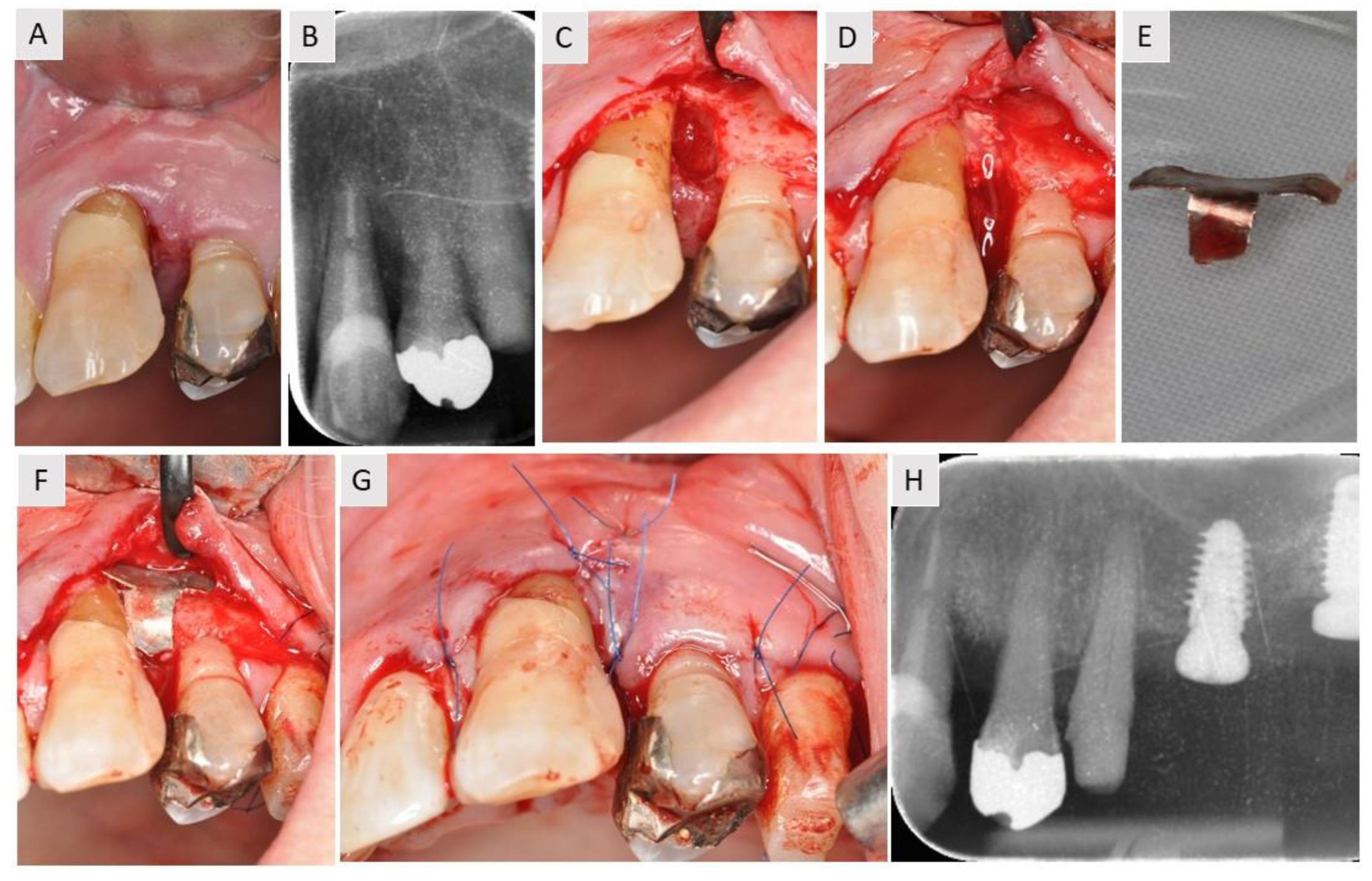 Medicina 59 02018 g002