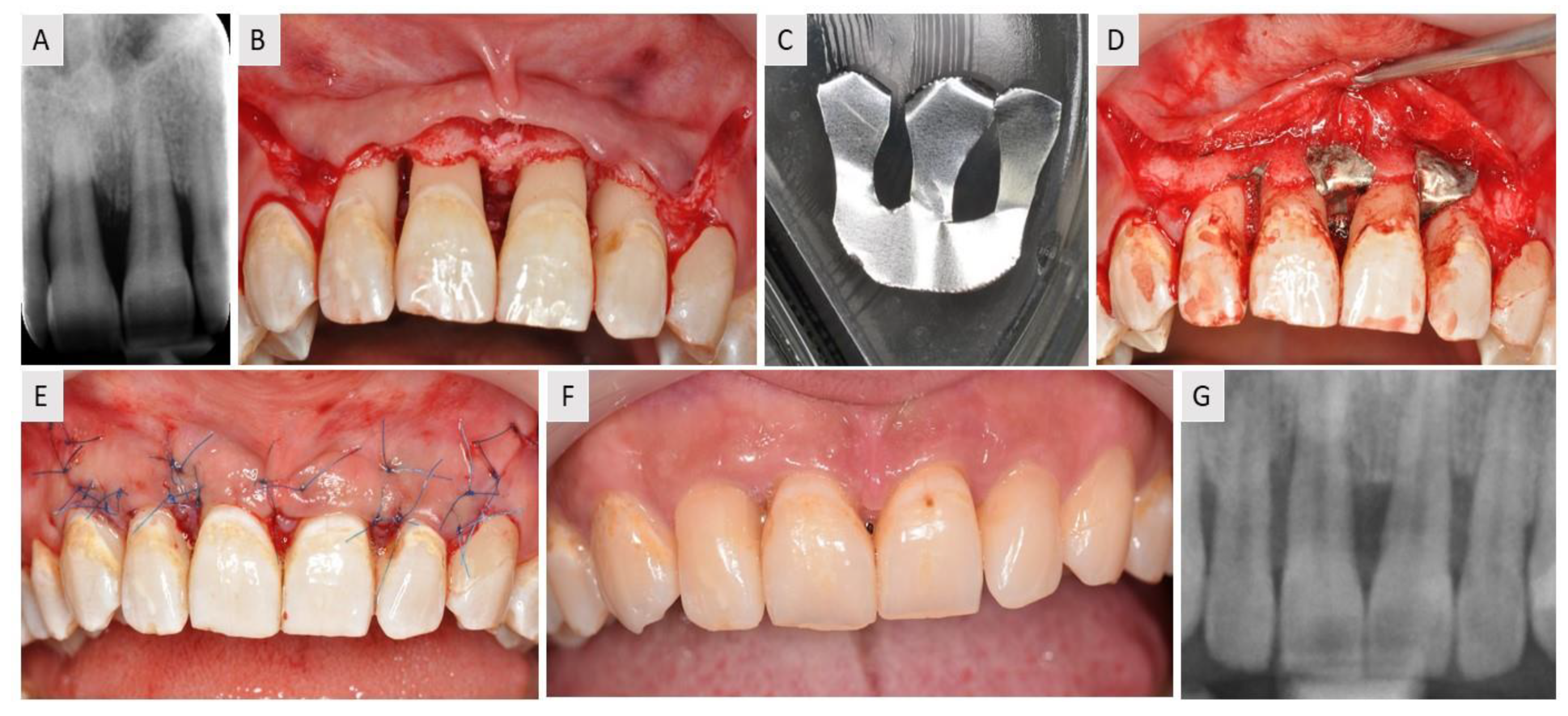 Medicina 59 02018 g003