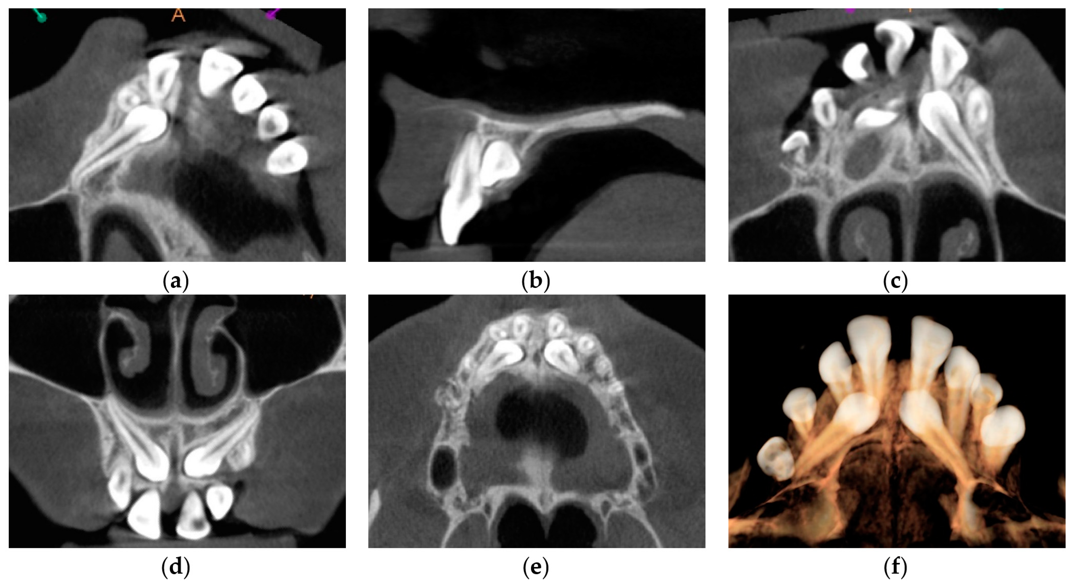 Medicina 59 02032 g005