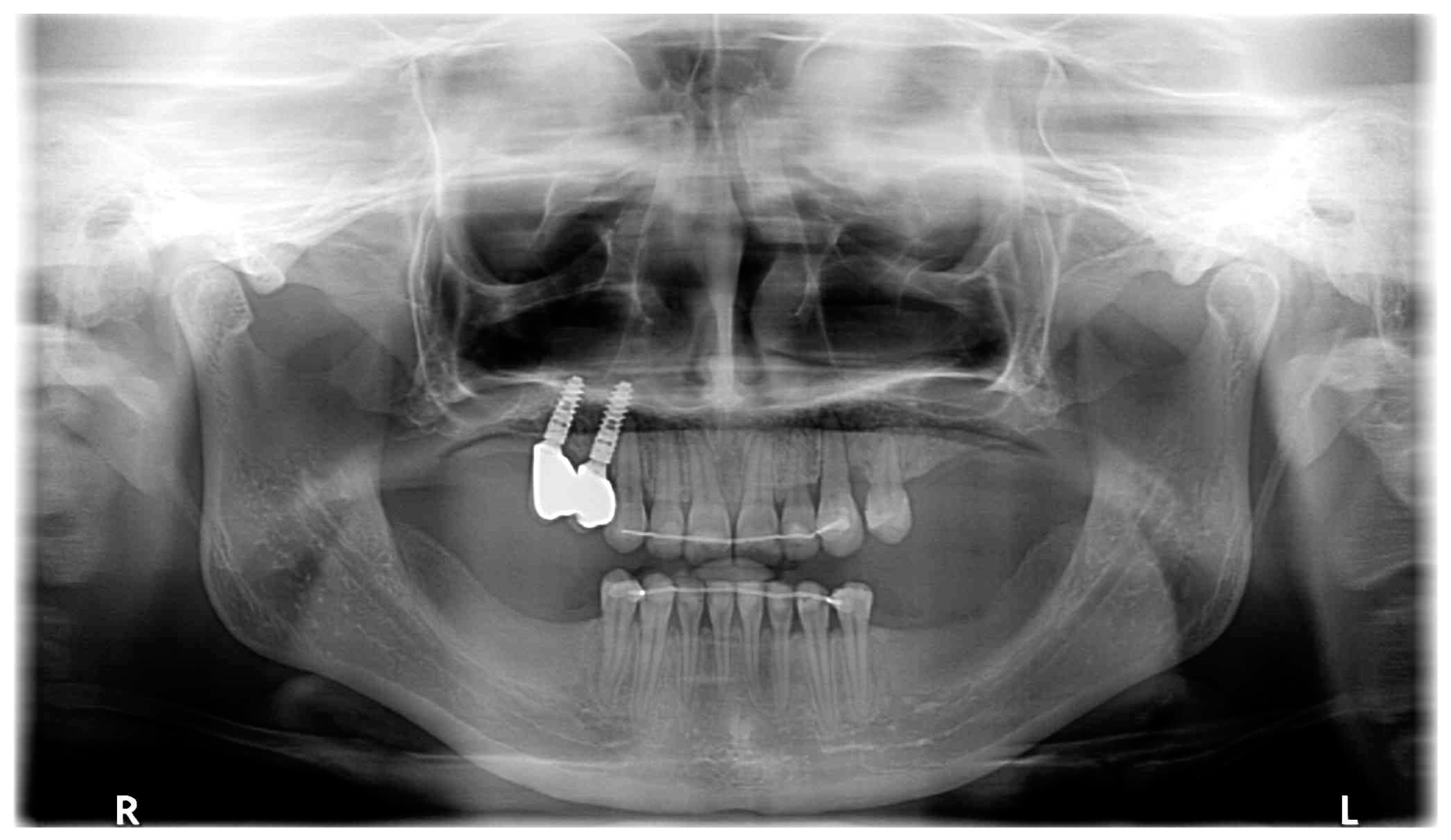 Medicina 59 02032 g011