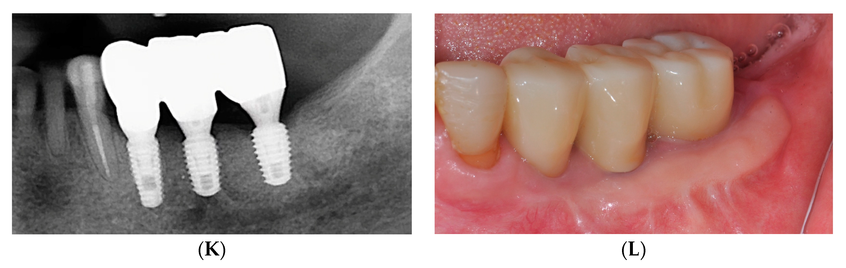 Medicina 59 02062 g002b