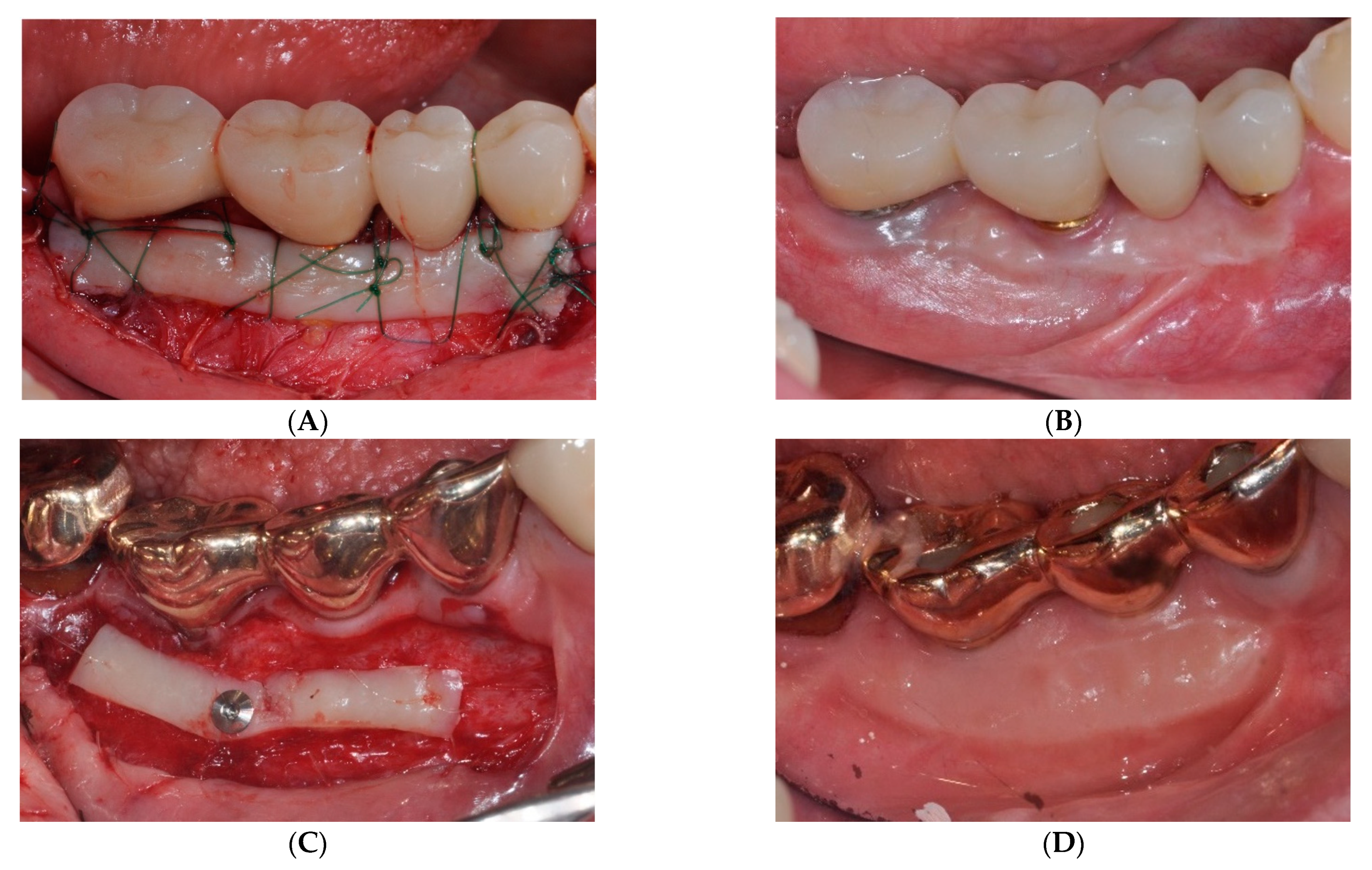 Medicina 59 02062 g003