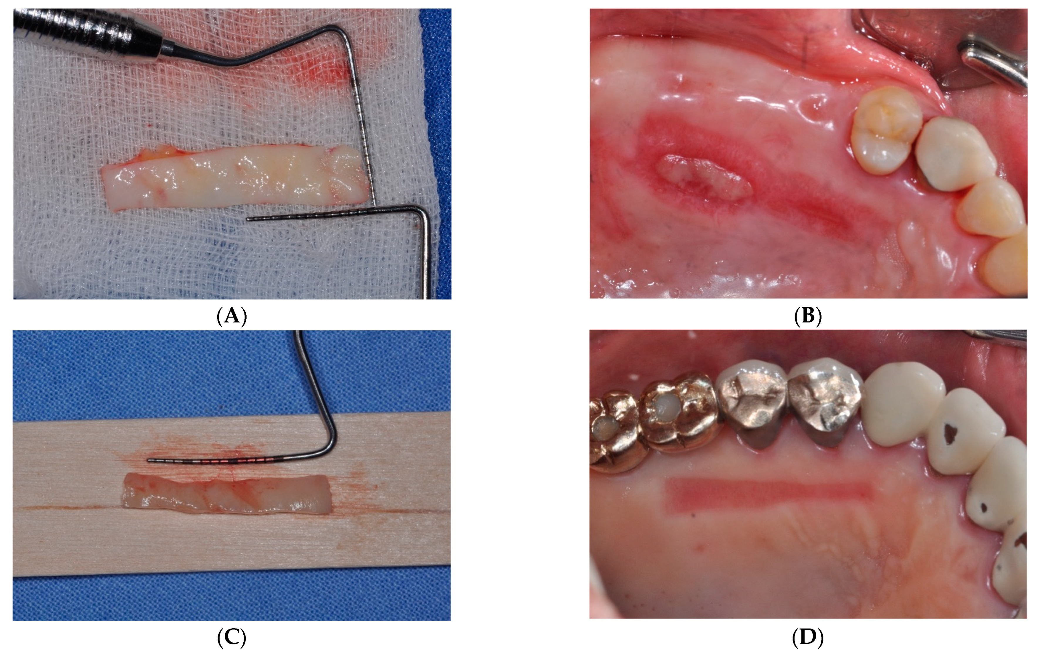 Medicina 59 02062 g005