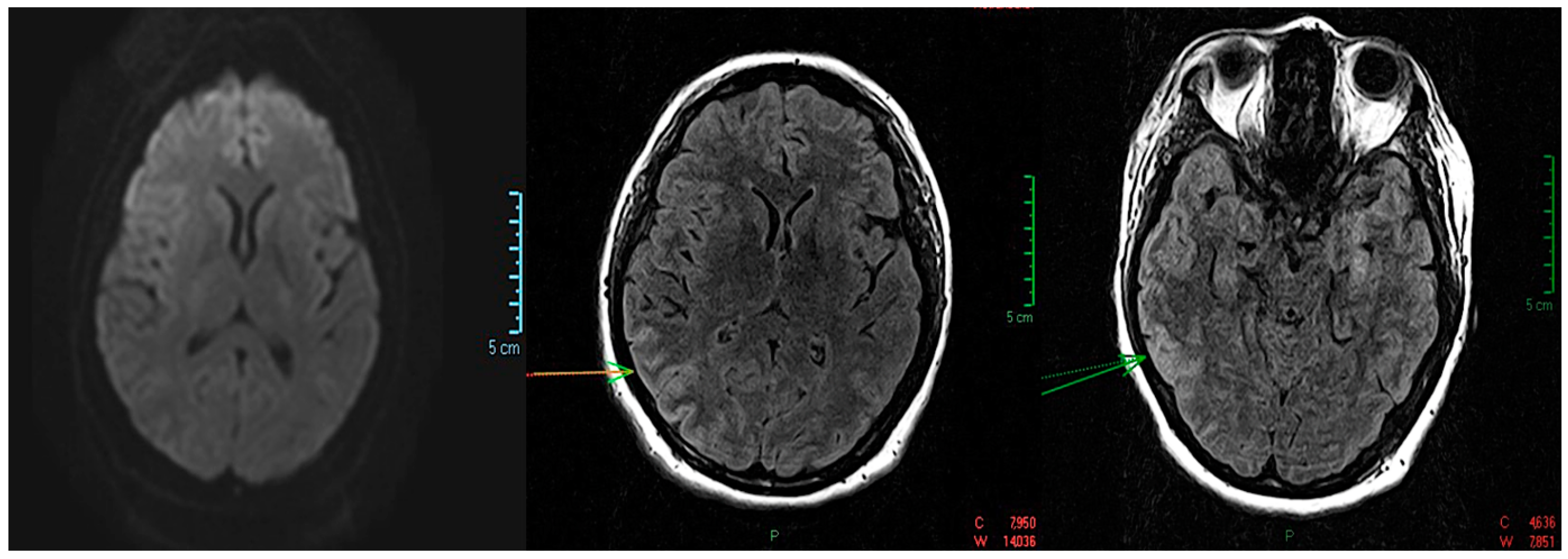 Medicina 59 02110 g001 Medicina 59 02110 g001