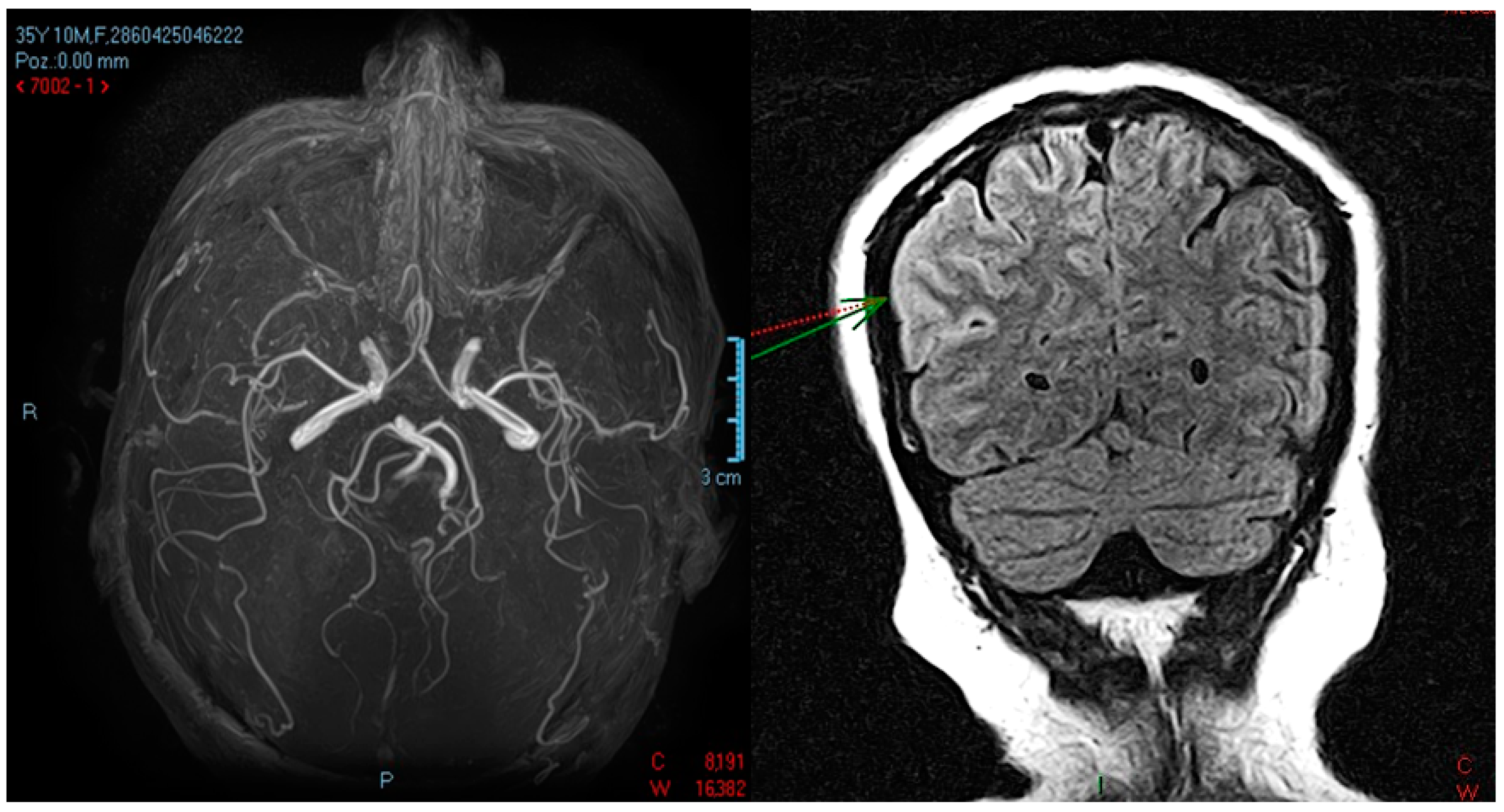 Medicina 59 02110 g002 Medicina 59 02110 g002
