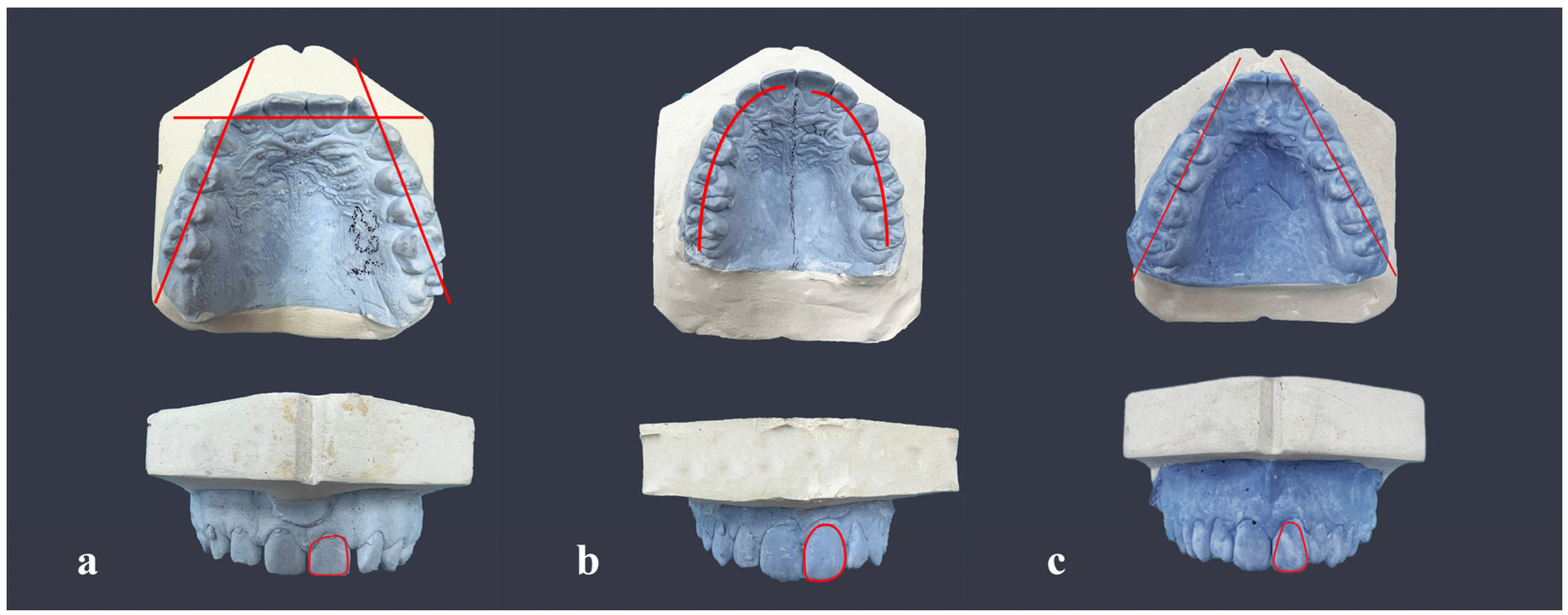 Medicina | free full-text | correlation theory of the maxillary central