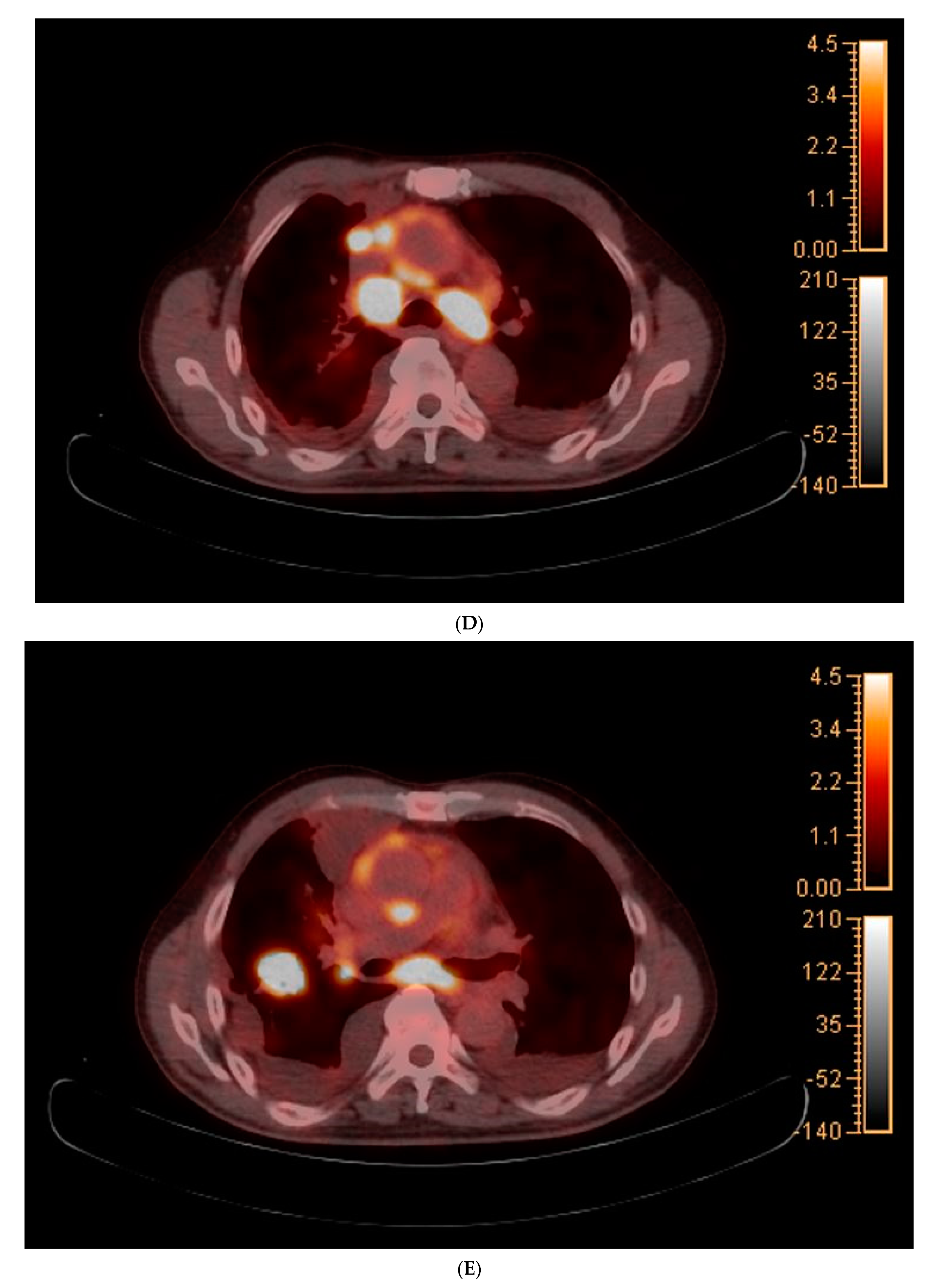 Medicina 59 02144 g002c