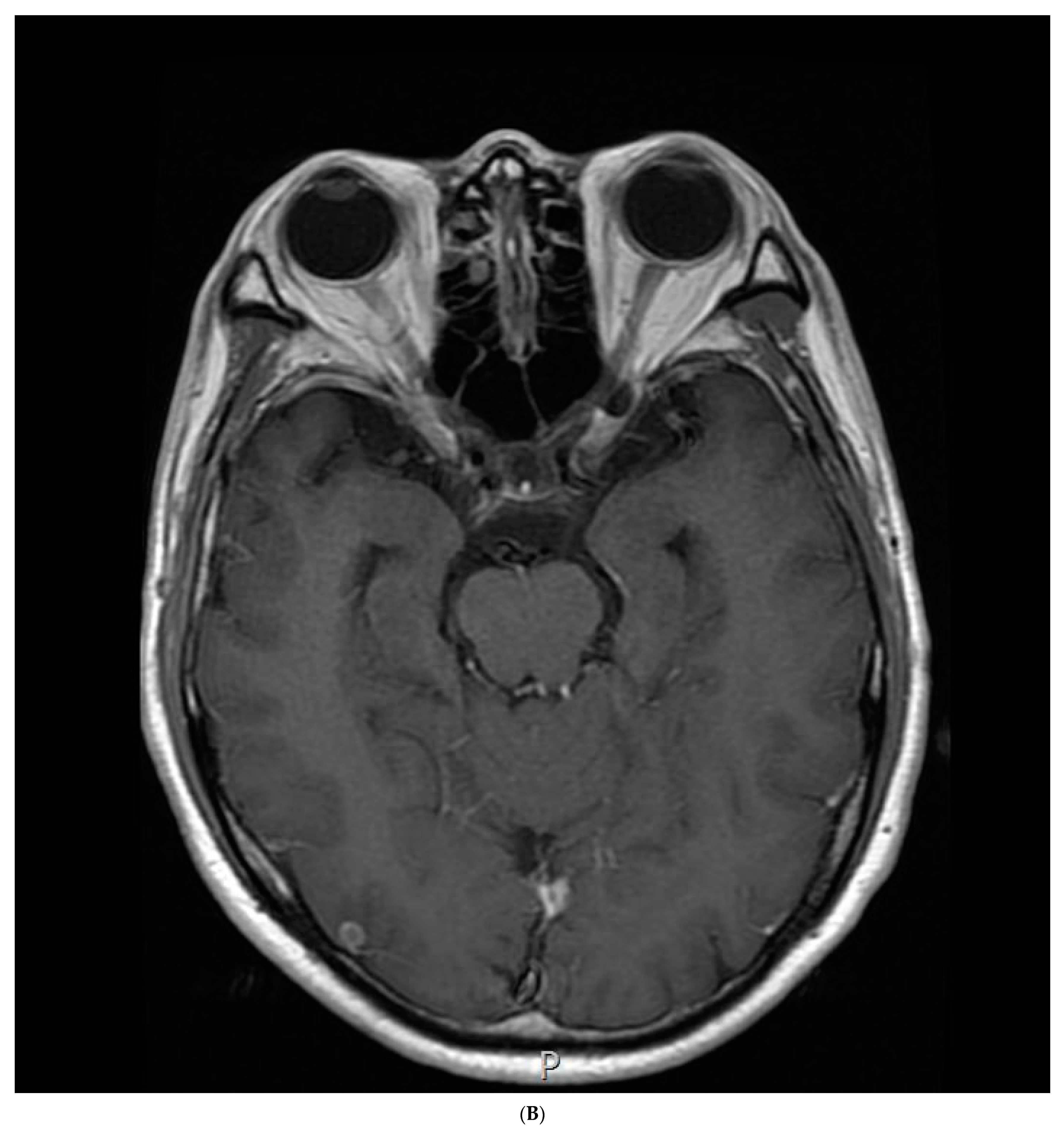 Medicina 59 02144 g003b