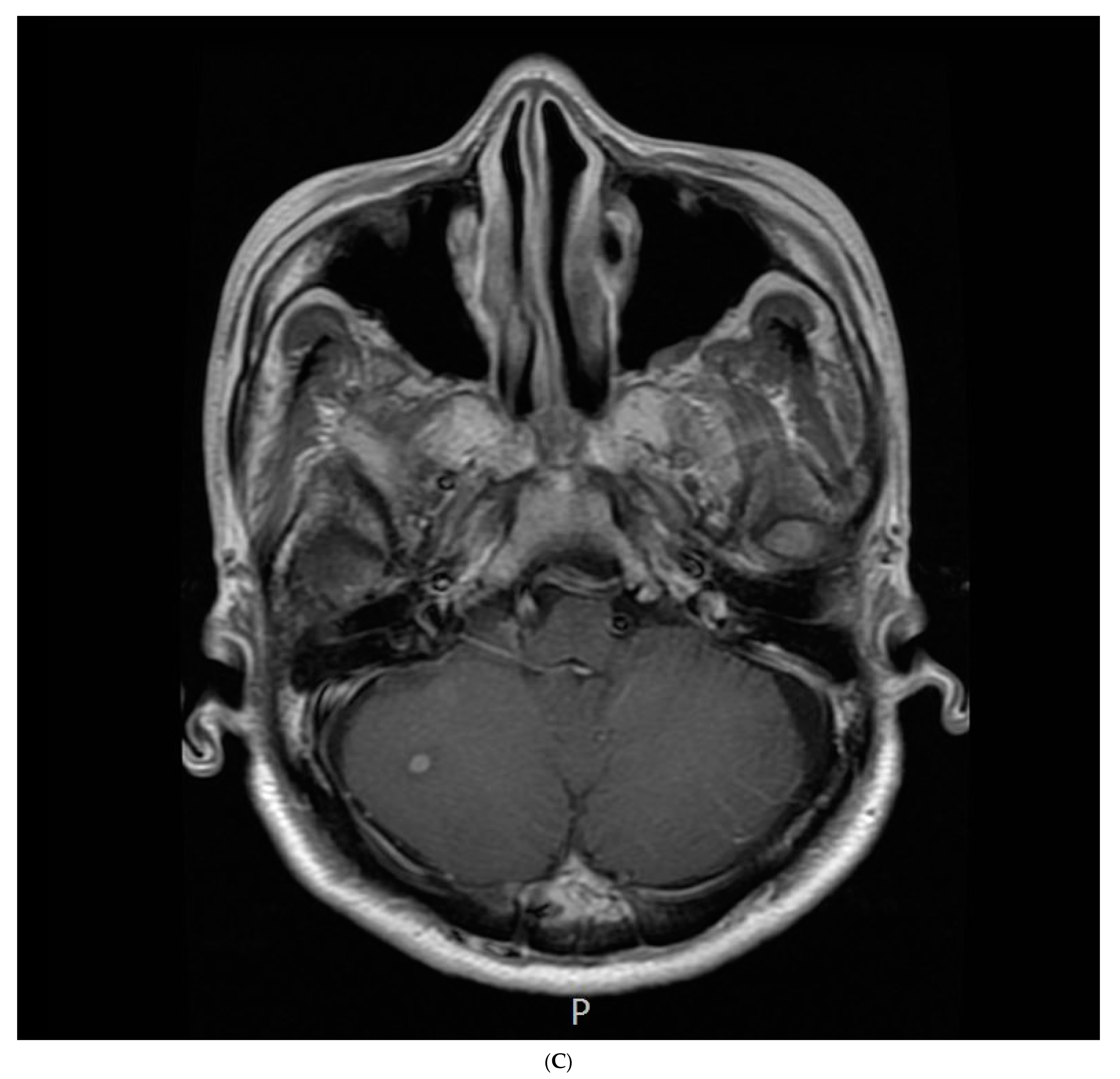 Medicina 59 02144 g003c