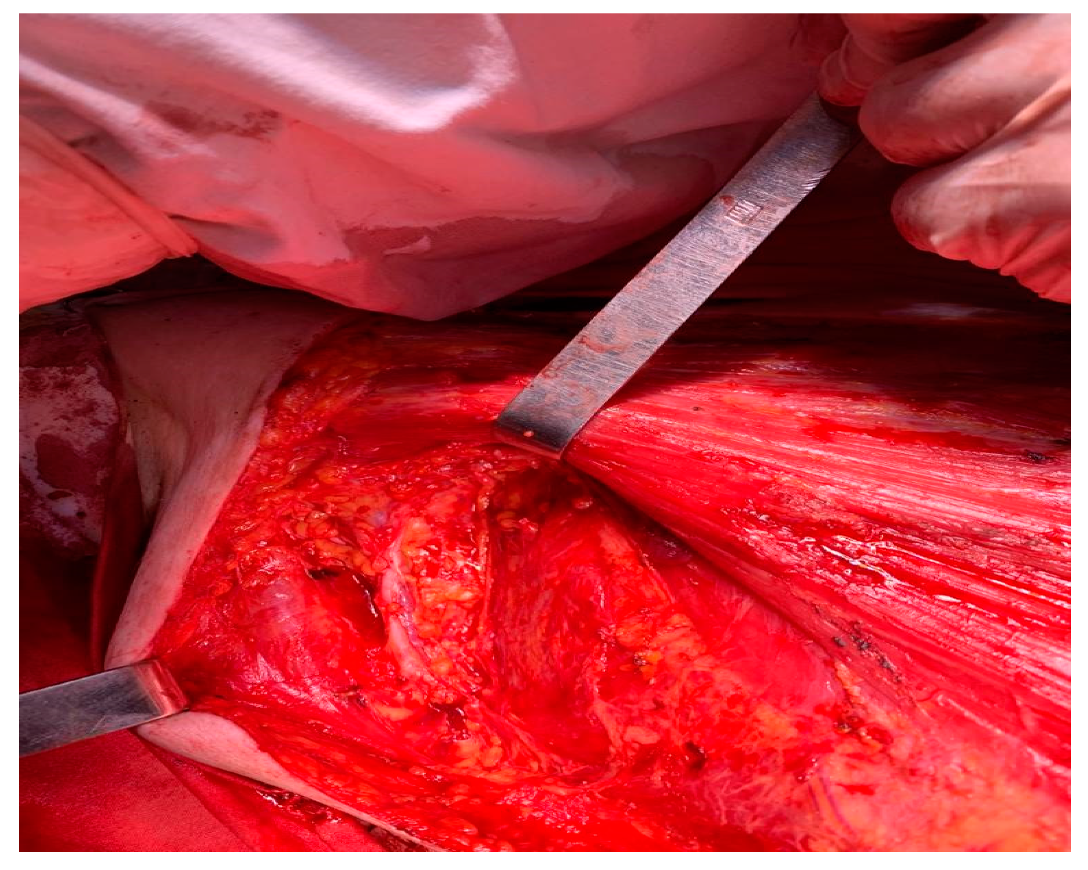 Medicina 59 02167 g004