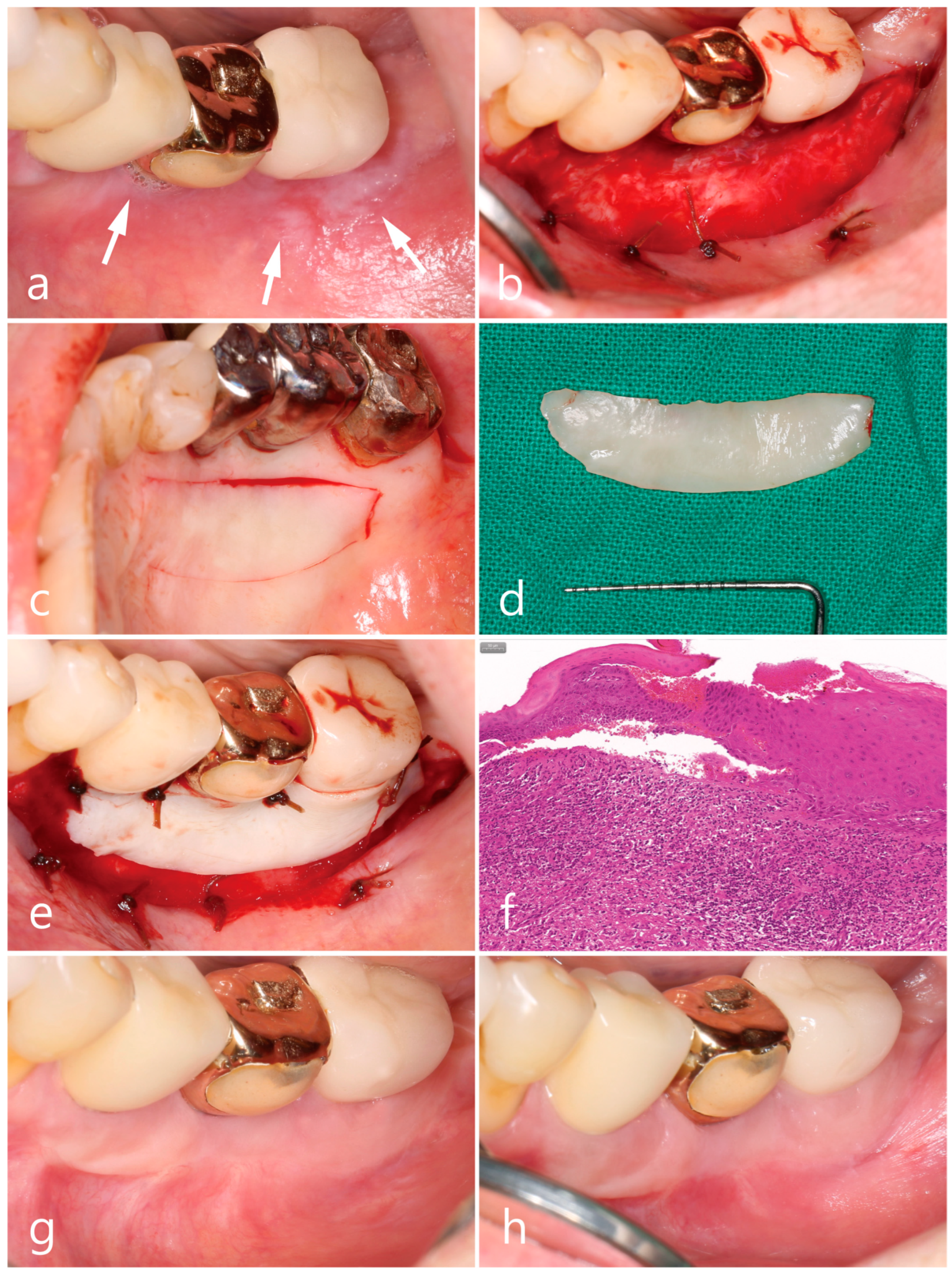 Medicina 59 02188 g004