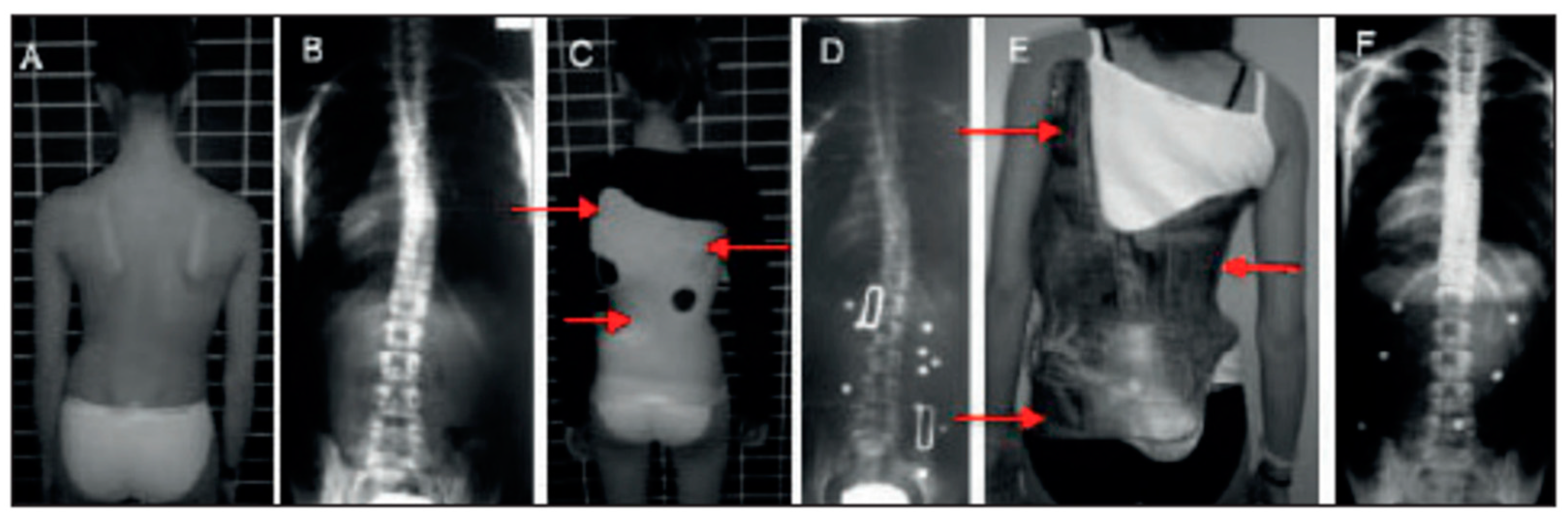 Medicina 60 00003 g001