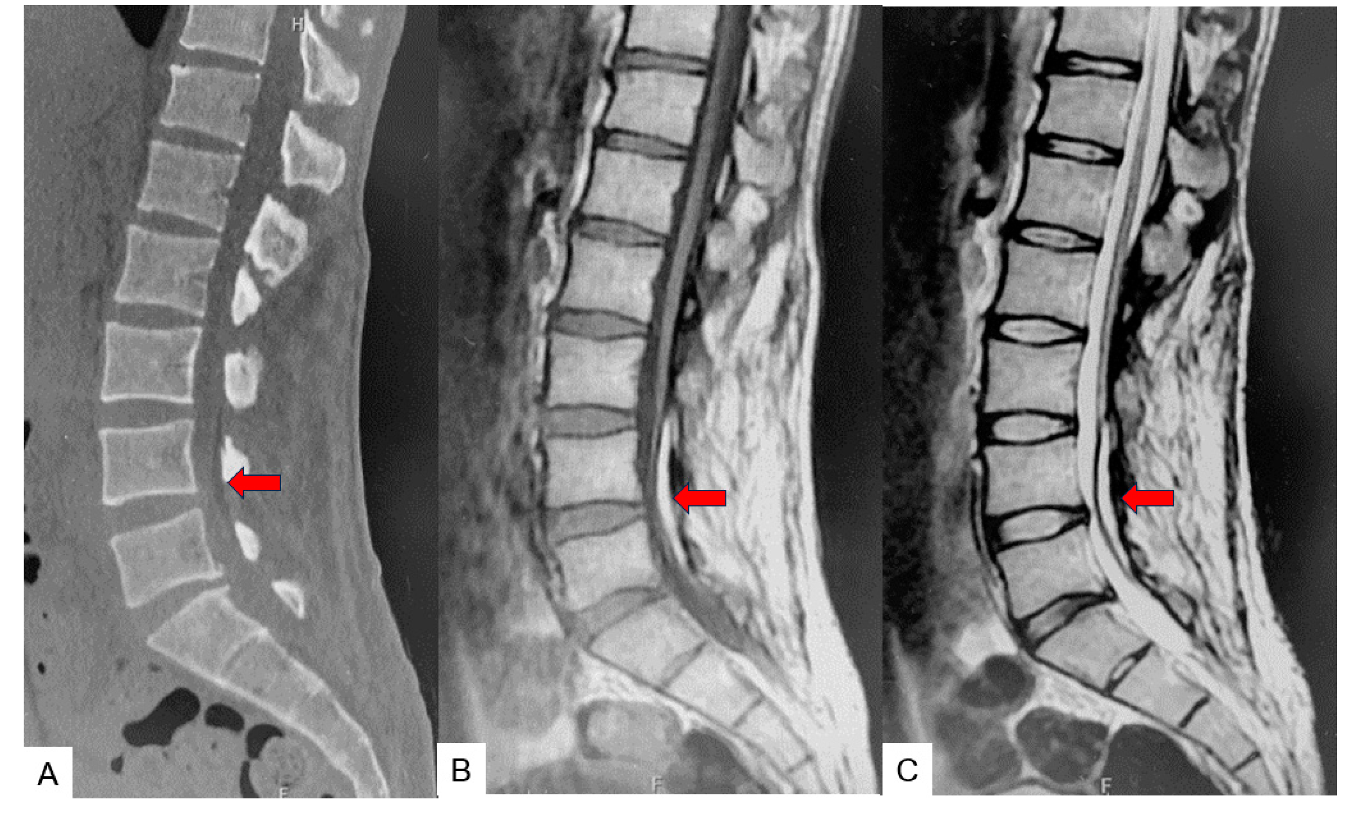 Medicina 60 00020 g002