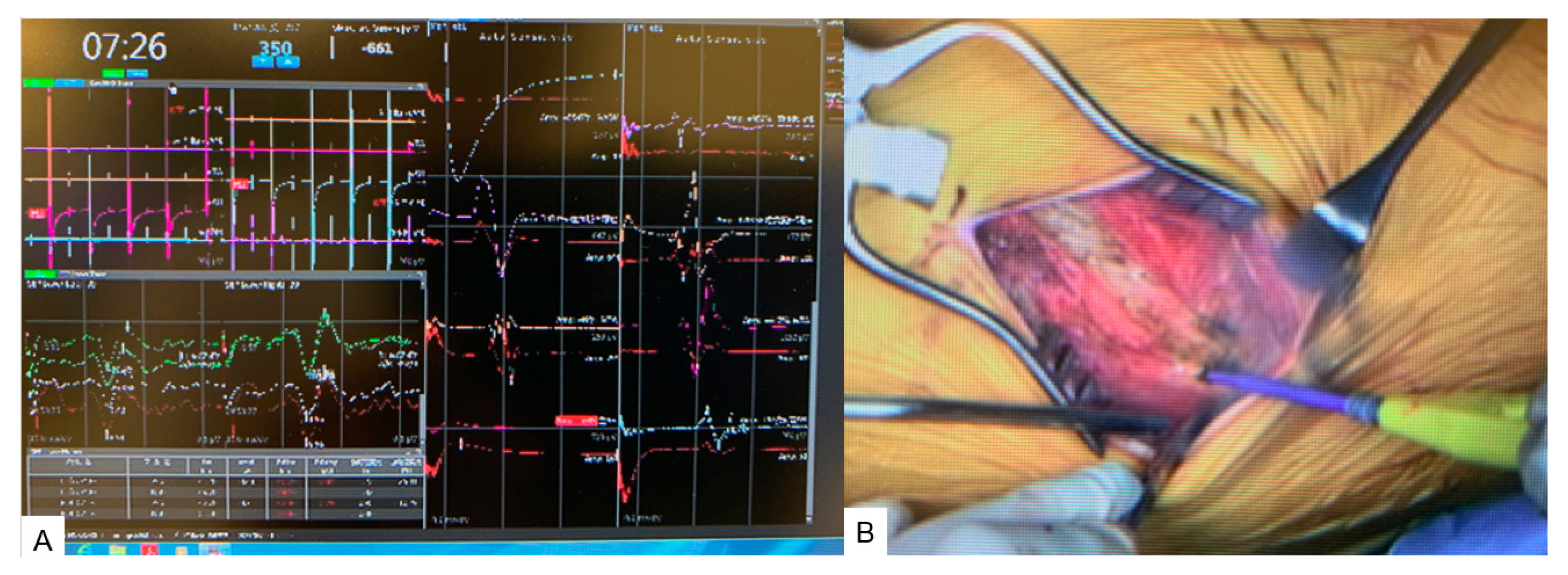 Medicina 60 00020 g003