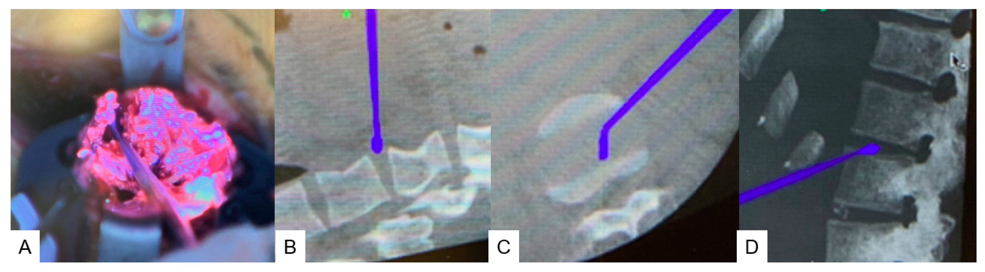 Medicina 60 00020 g005