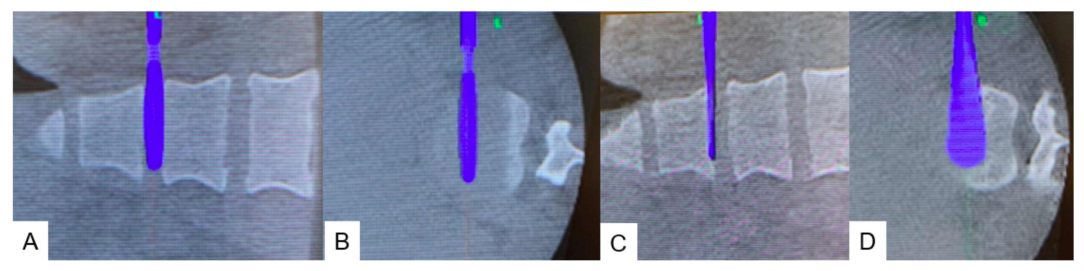 Medicina 60 00020 g006