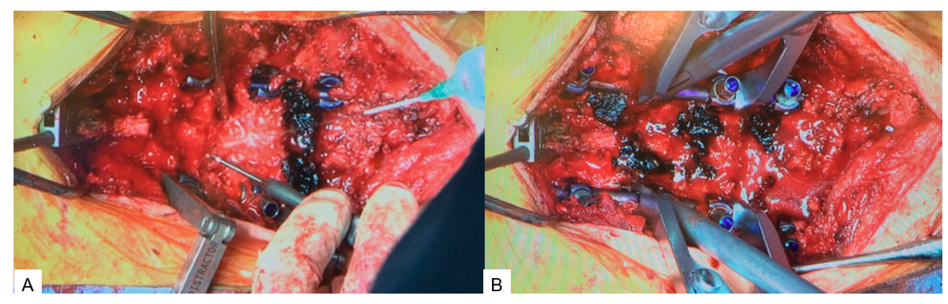 Medicina 60 00020 g007