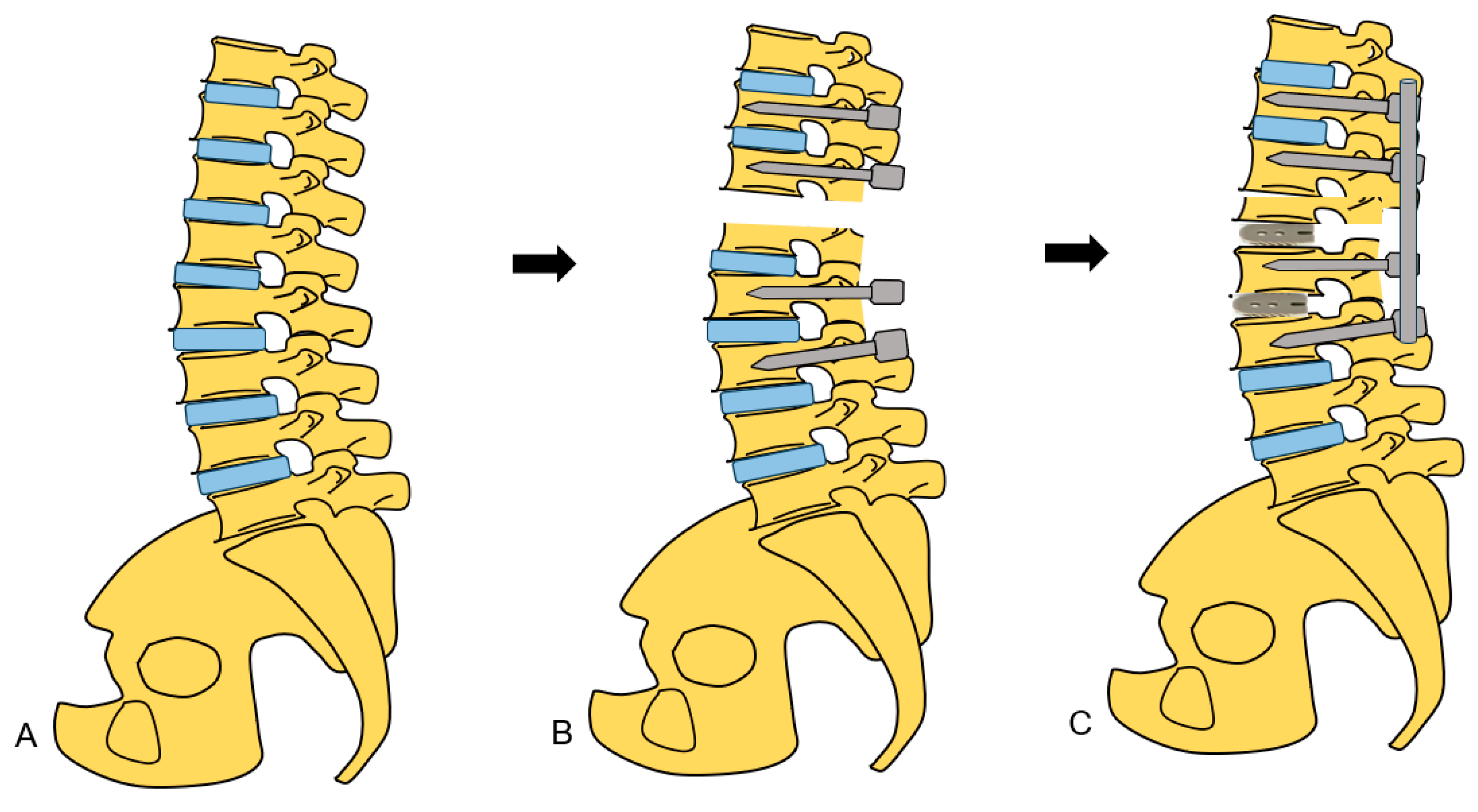 Medicina 60 00020 g013