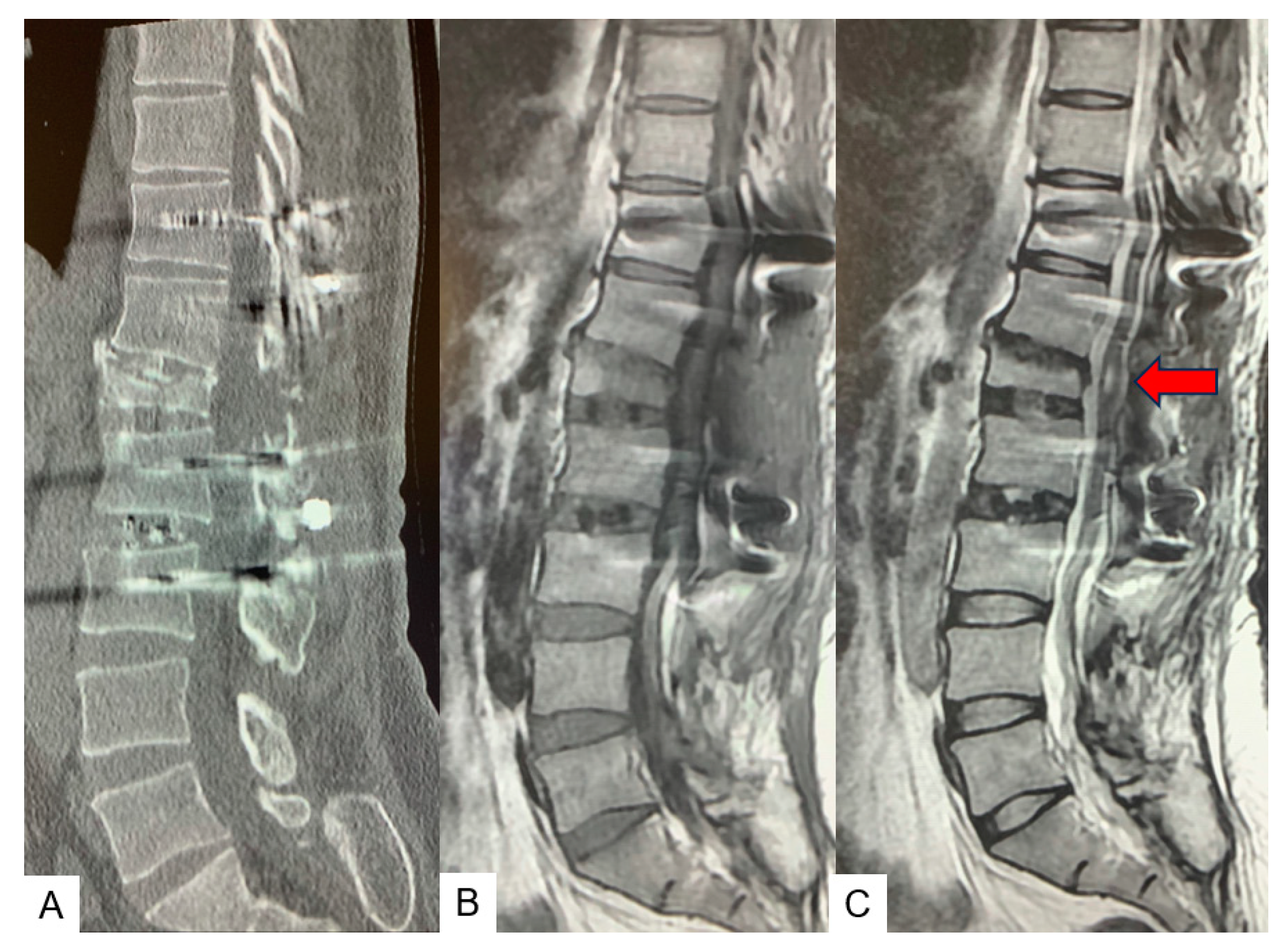 Medicina 60 00020 g015