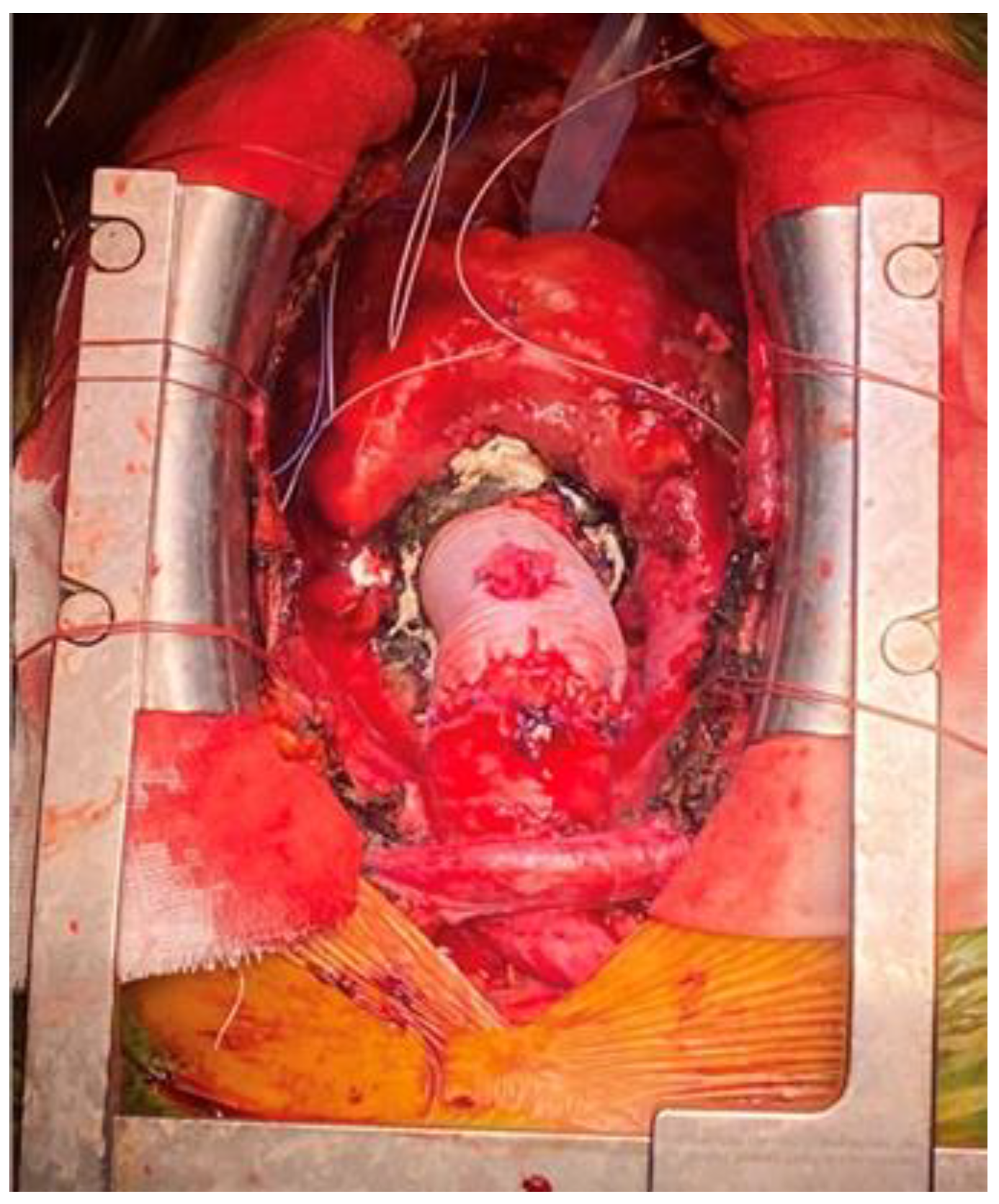 Medicina 60 00027 g001